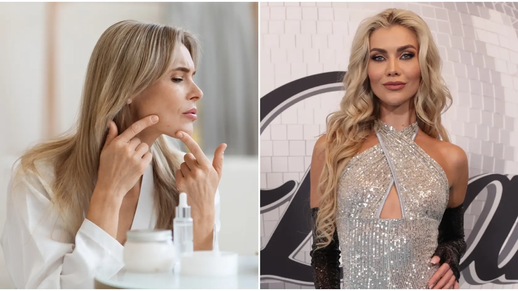 Aj Daniela Vojtasová bojovala s akné. 