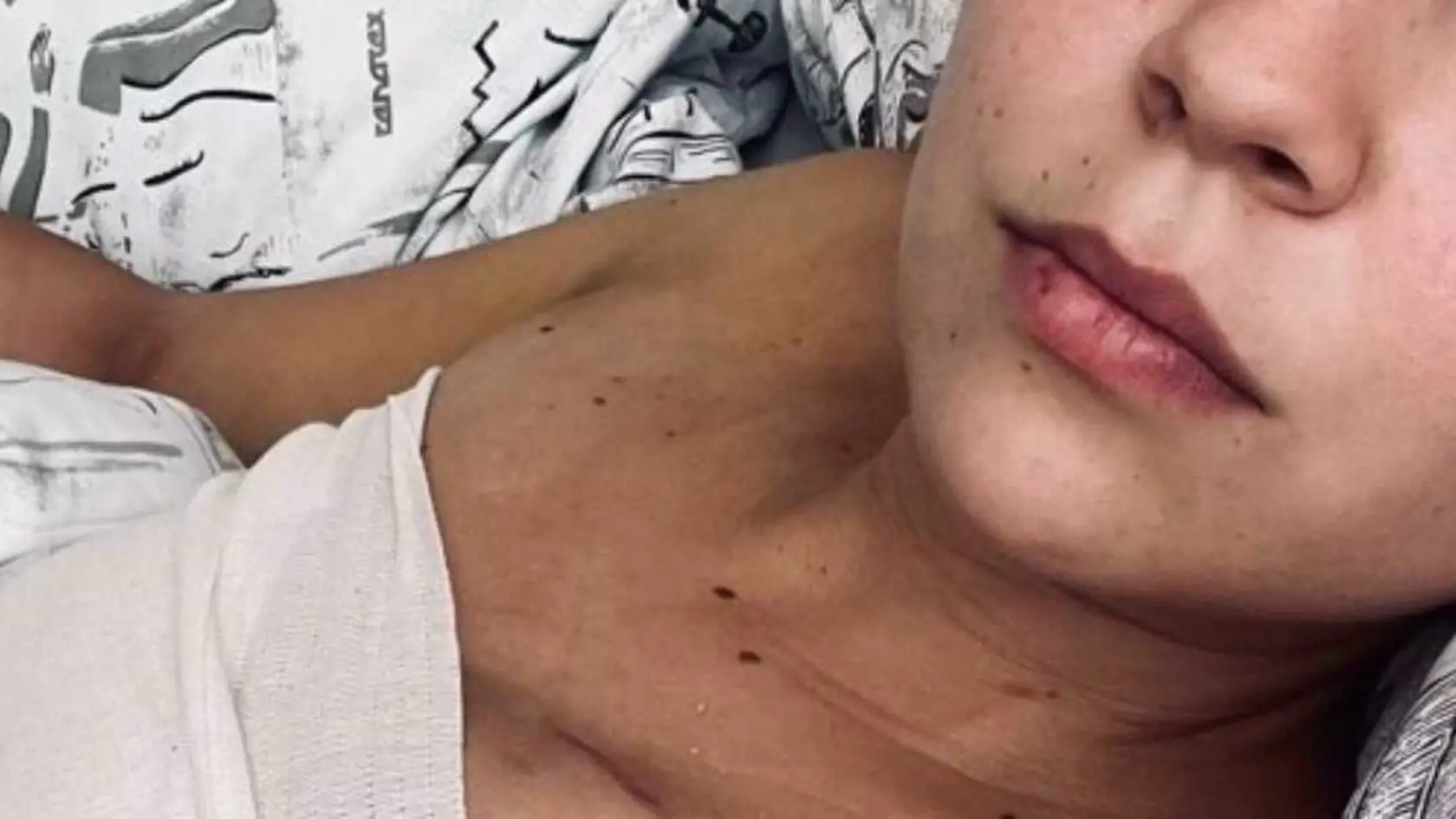 Zdalo sa, že Patrícia je z najhoršieho vonku. Žiaľ, prišla mimoriadne smutná správa.
