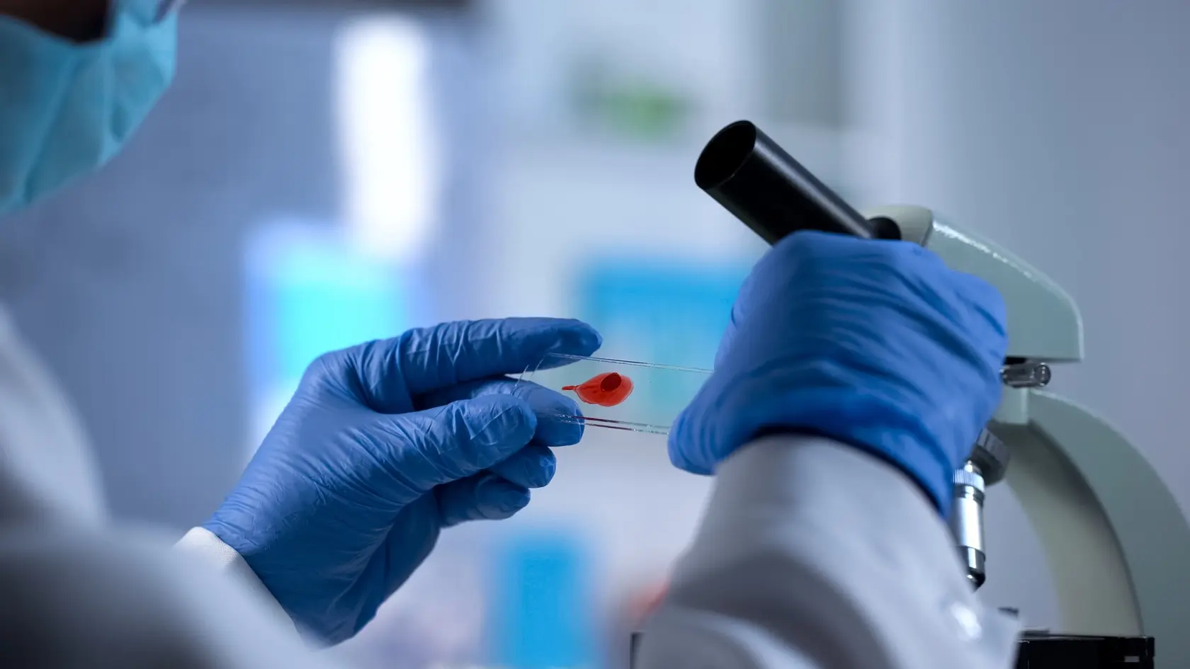 Medzi ruskými vojakmi sa objavili prípady HIV (ilustr. foto)