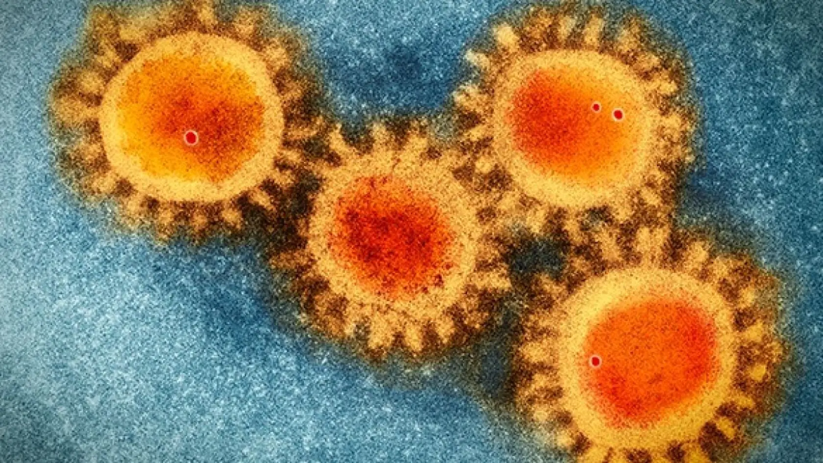 Koronavírusovým variantom omikron sa môžu vo väčšej miere ako pri iných variantoch nakaziť aj očkovaní ľudia. Očkovanie však poskytuje aj pri omikron variante vysoký stupeň ochrany pred závažným priebehom ochorenia a hospitalizáciou.