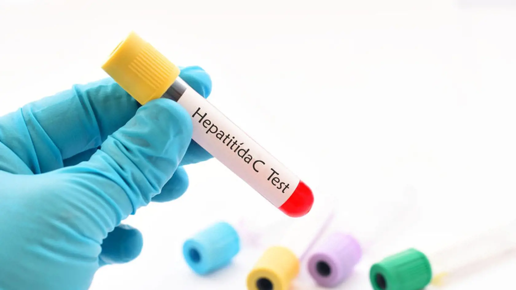Na hepatitídu sa môžete otestovať.