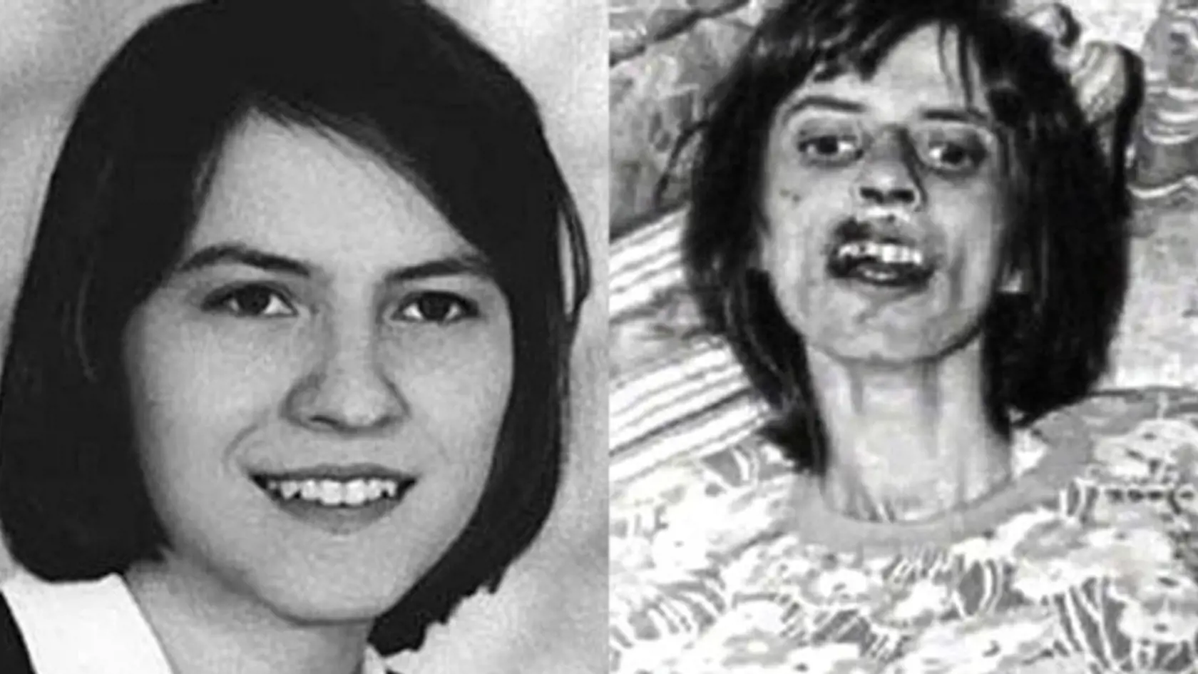 Aneliene Michel - dievča posadnuté diablom - takto vyzerala na začiatku a krátko pred smrťou.