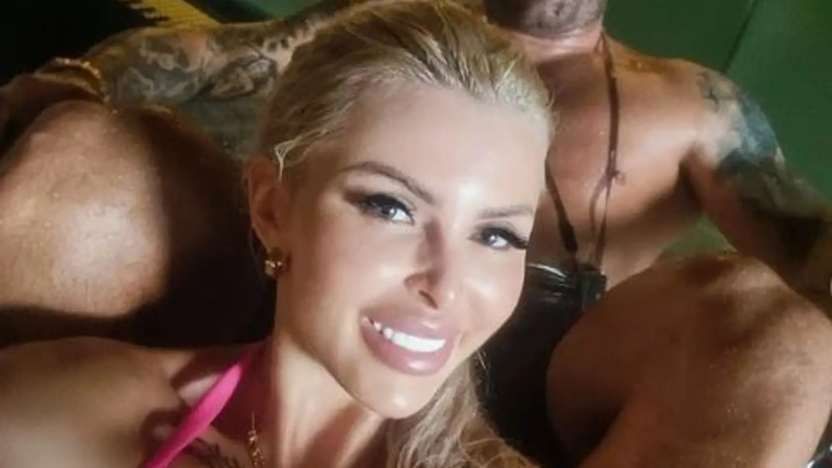 Karlos a Lela. Takto vyzerala pred druhou operáciou nosa.
