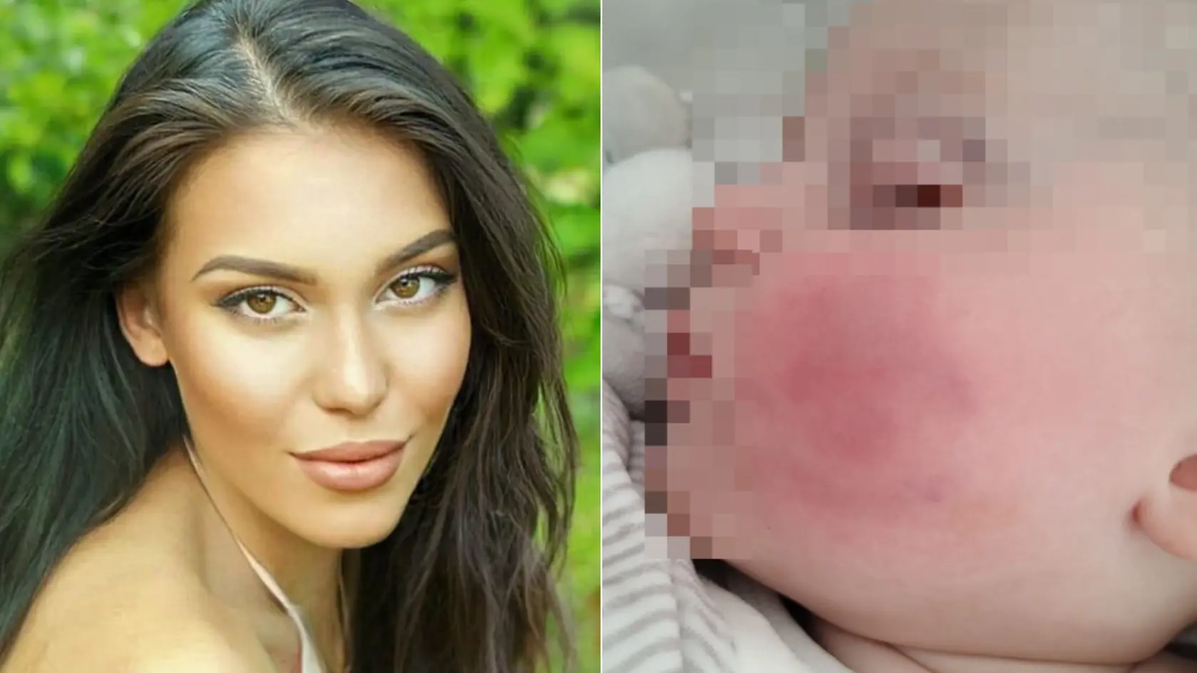 Bianca bola so synom aj u lekára.