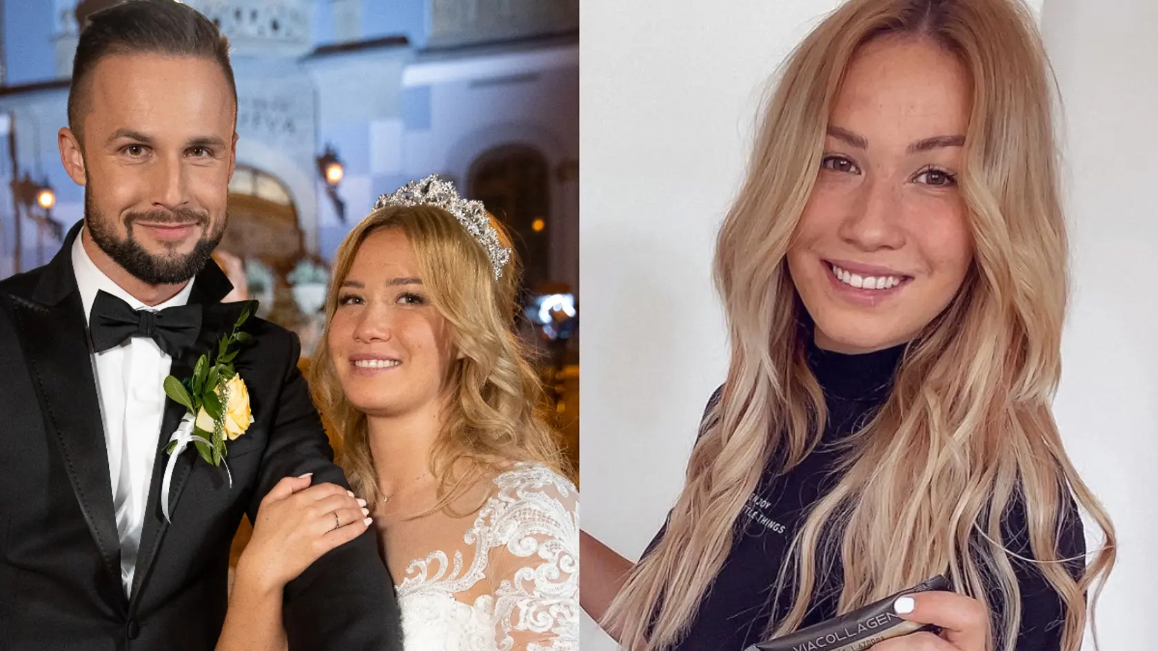 Tereza zo Svadby na prvý pohľad sa rozhodla pre plastickú operáciu pŕs.