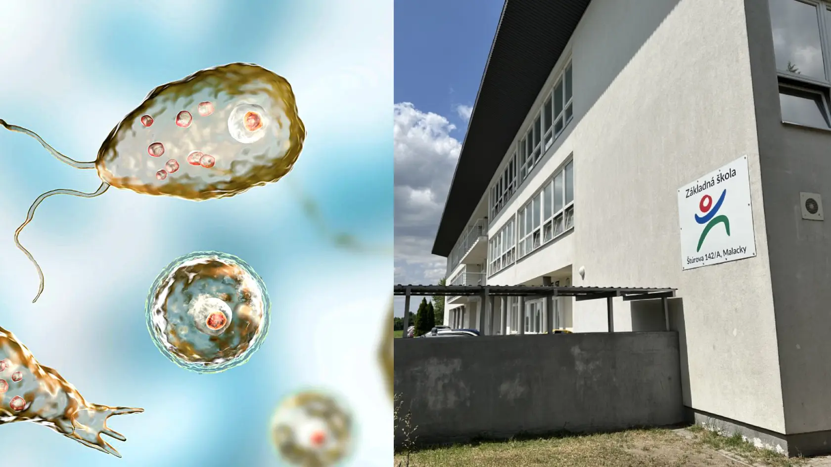 Mimoriadne smutná správa! Len pred pár dňami sme informovali o prípade 11-ročného chlapca zo Záhoria, ktorý sa mal nakaziť smrteľne nebezpečným parazitom slzovničkou zhubnou, spôsobujúcim rozožieranie a opuch mozgu. Z nemocnice teraz prišli najhoršie správy - chlapček v utorok (17. 6.) tomuto ochoreniu, žiaľ, podľahol. 