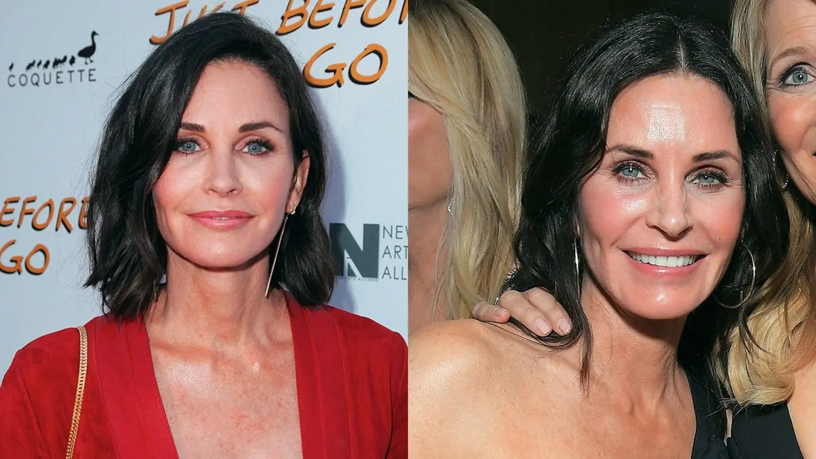 Courteney Cox priznala, že v minulosti bol na ňu vyvíjaný nátlak zo strany producentov a preto sa rozhodla, že si nechá do tváre aplikovať botoxové výplne. To však v roku 2016 oľutovala a nechala si ich rozpustiť.