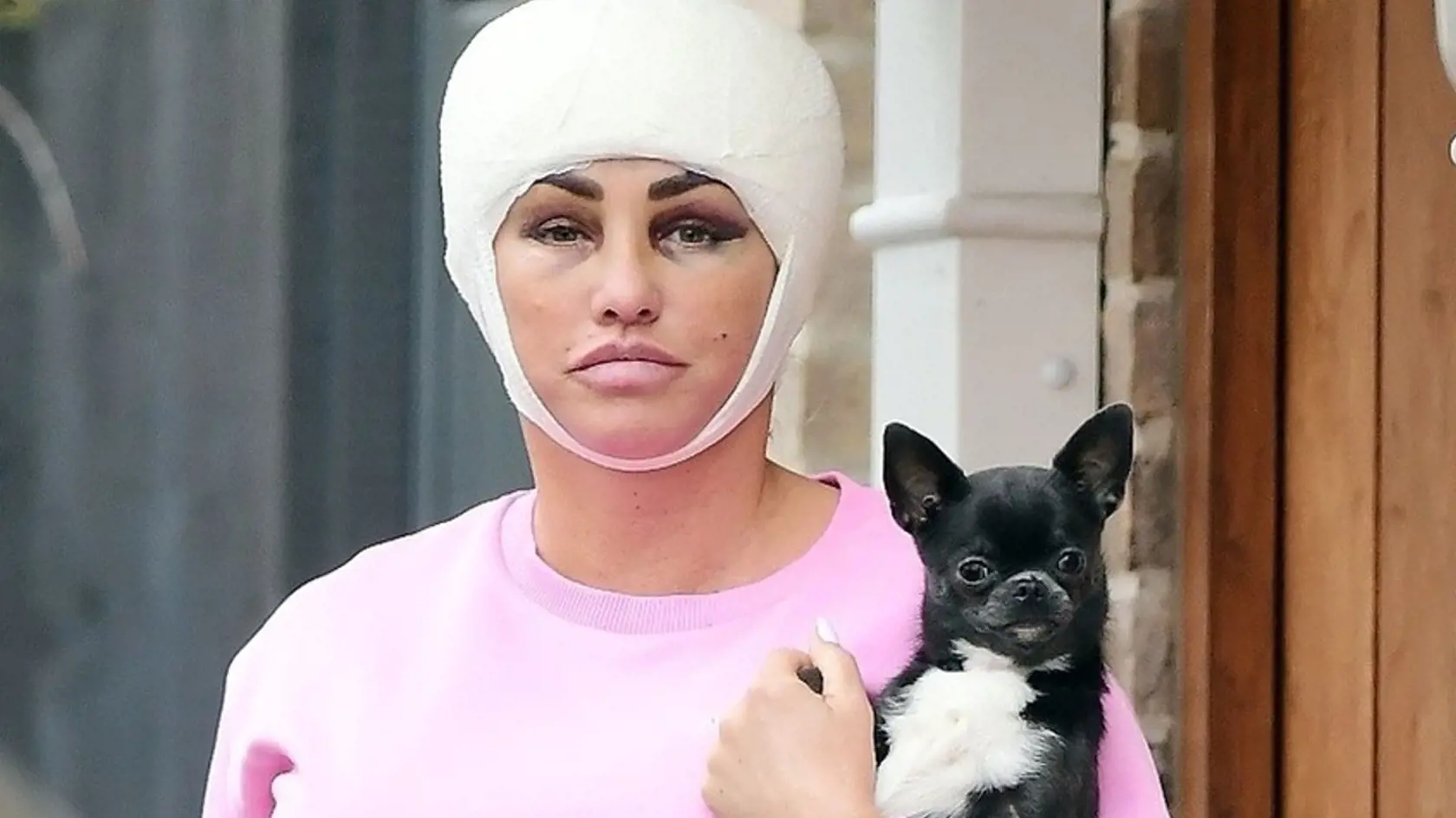 Katie Price podstúpila ďalšie plastiky.