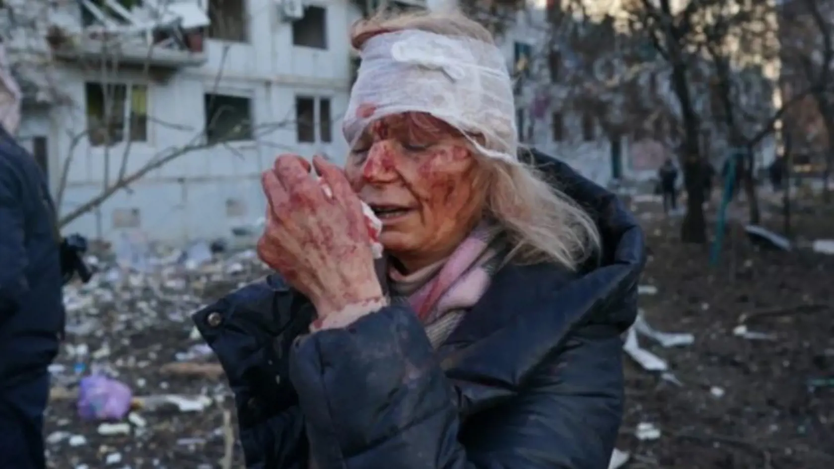 Olena Kurilo (52) po bombardovaní v Charkove.