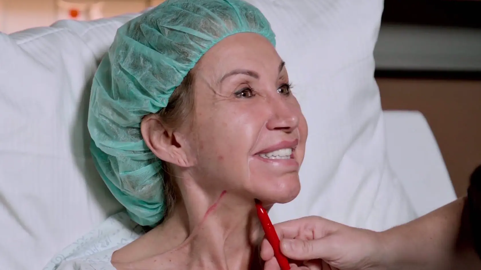 Carmen Geiss výrazne schudla a ovisla jej koža na tvári. Rozhodla sa to vyriešiť faceliftom. Išla po nôž. 