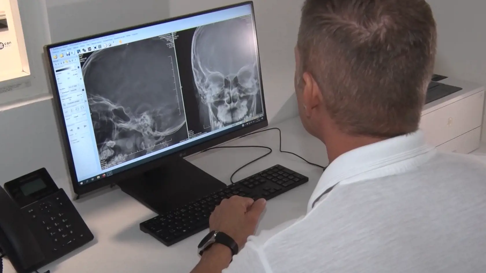 Milku museli s vážnymi zraneniami hospitalizovať v nemocnici v Bojniciach.