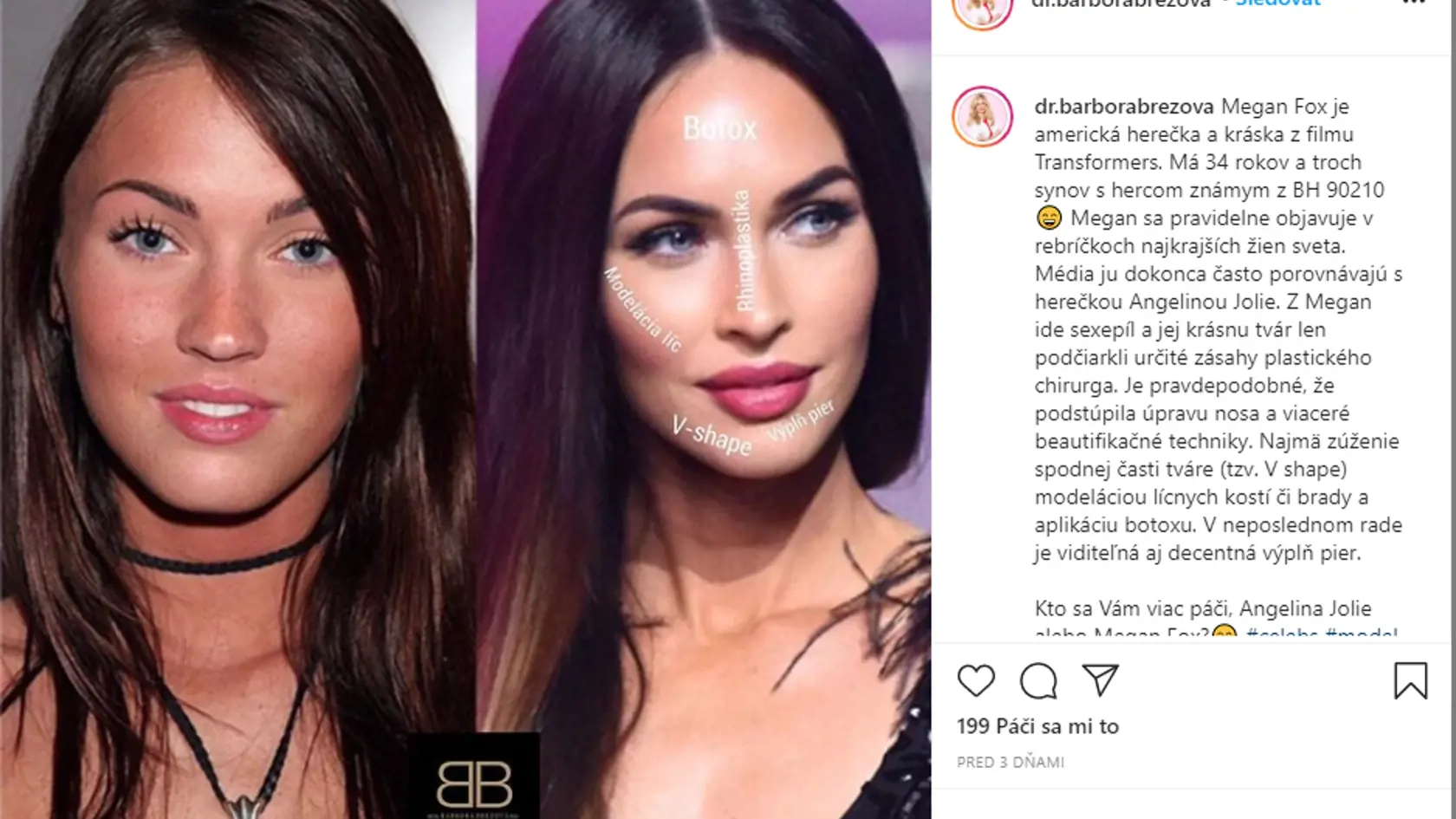 Herečka Megan Fox (34)