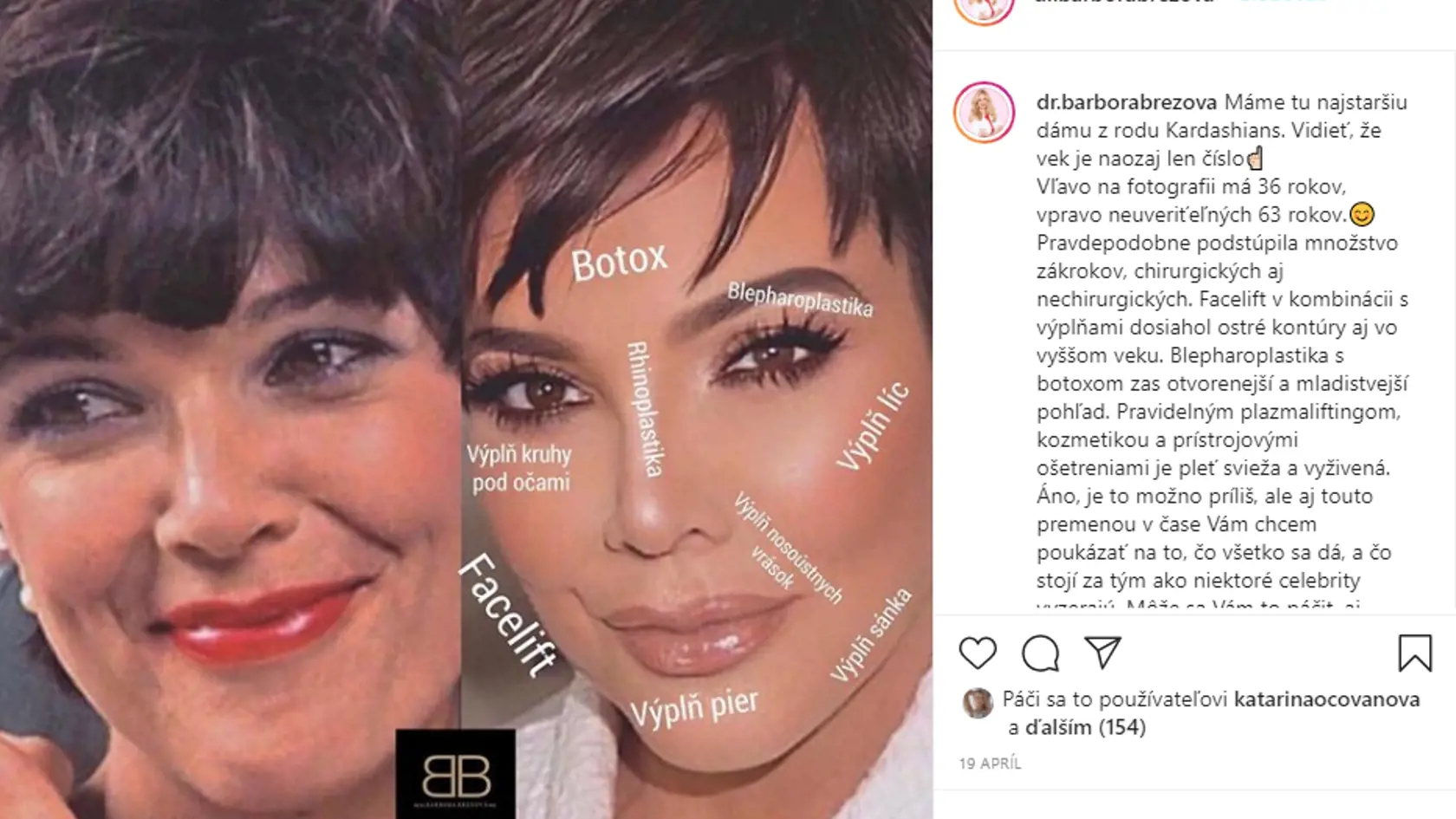 Kris Jenner (64)