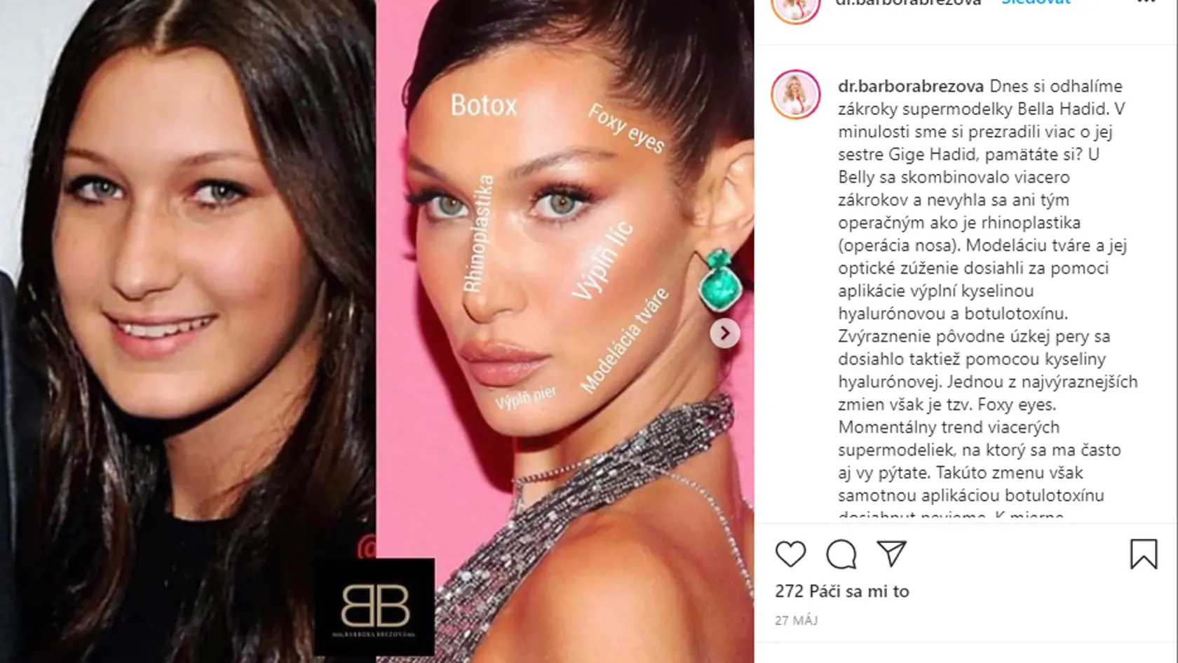 Modelka Bella Hadid (23)