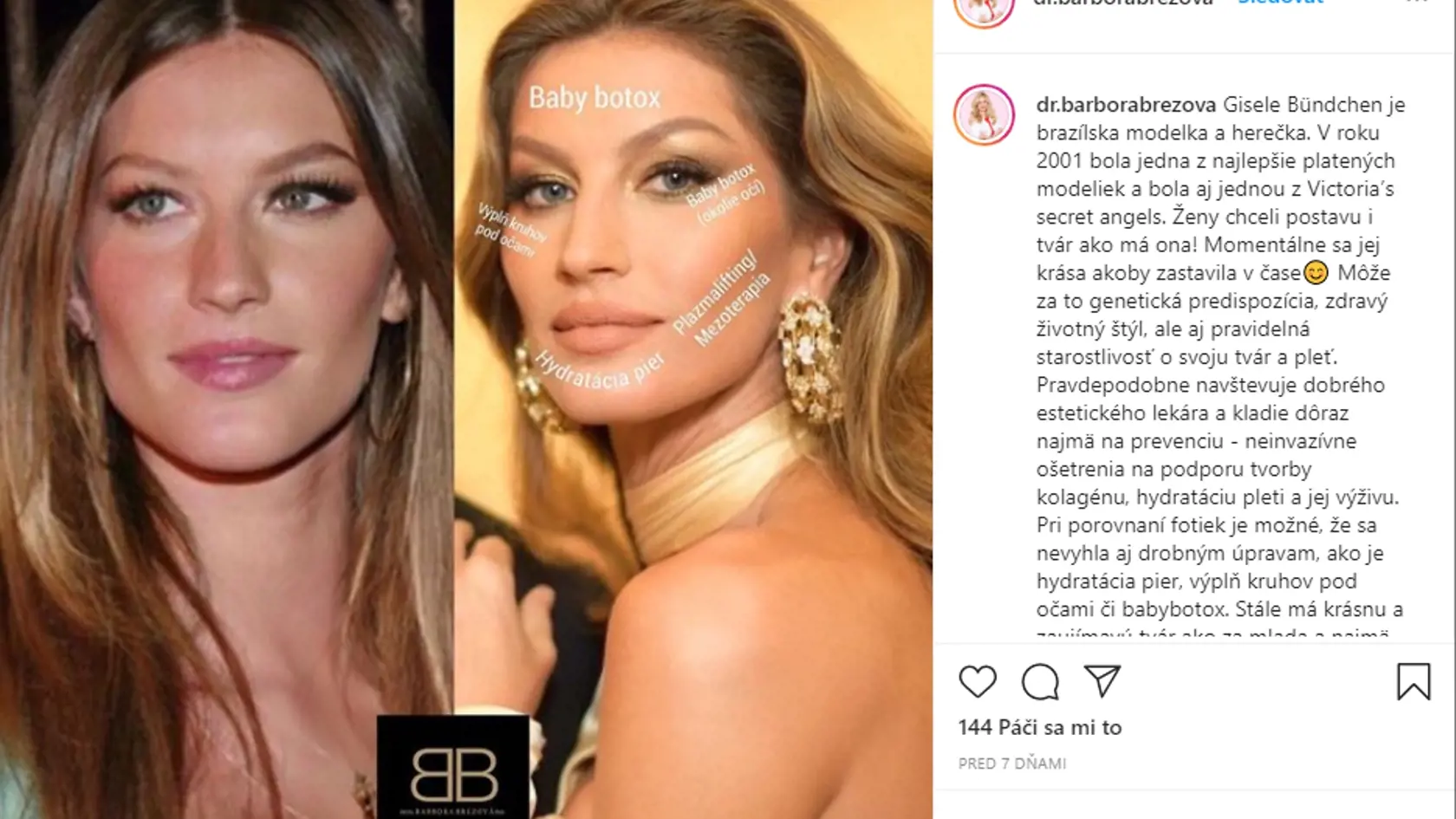 Brazílska herečka a modelka Gisele Bündchen (40)