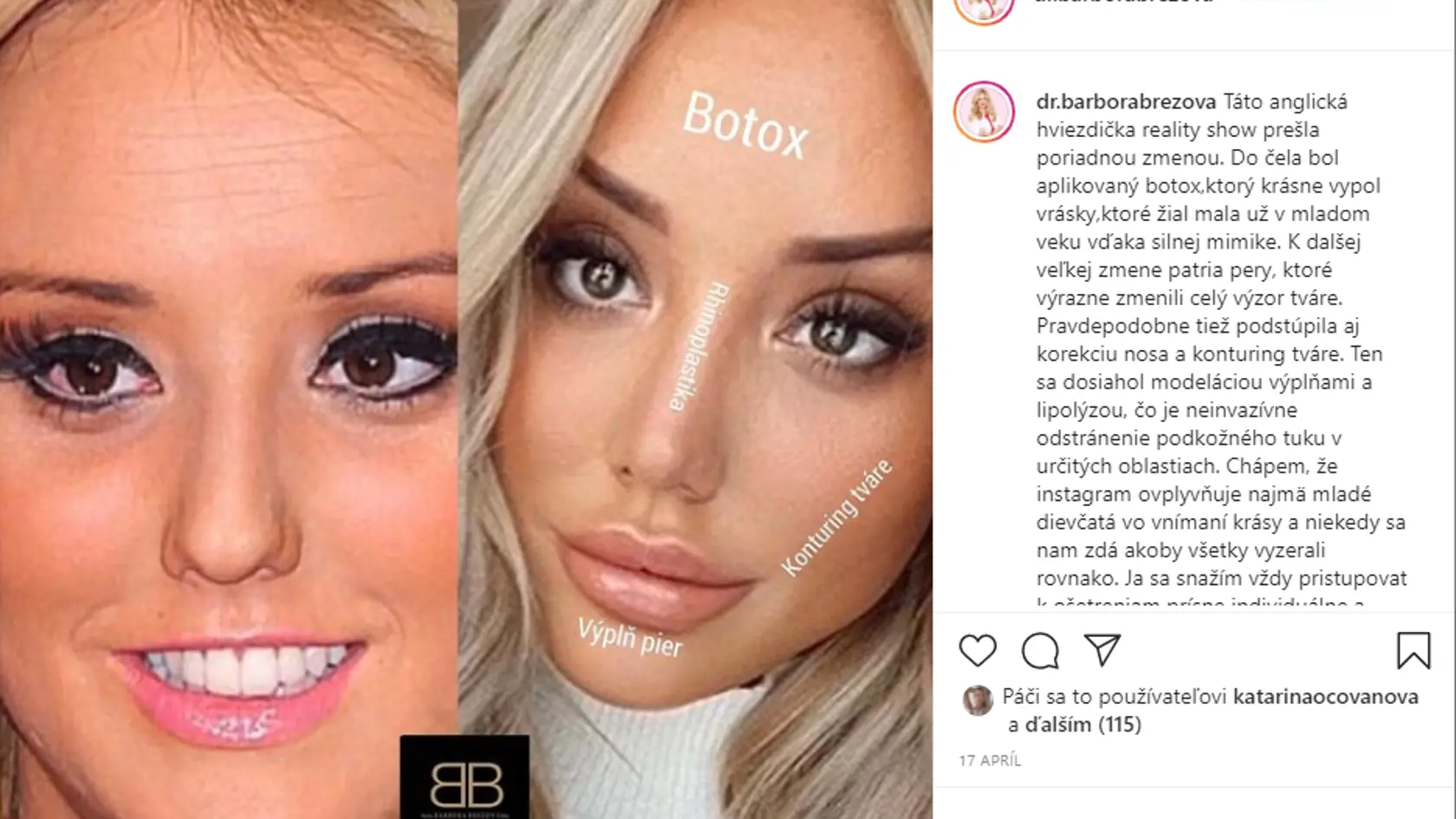 Anglická hviezdička reality šou si prešla azda najväčšou premenou.