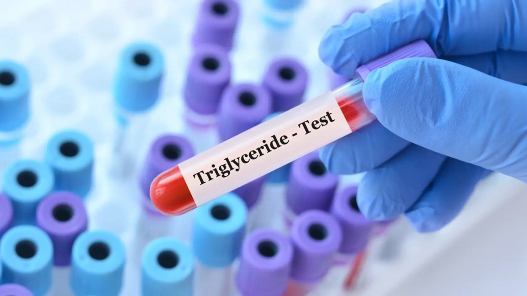 Test na triglyceridy.
