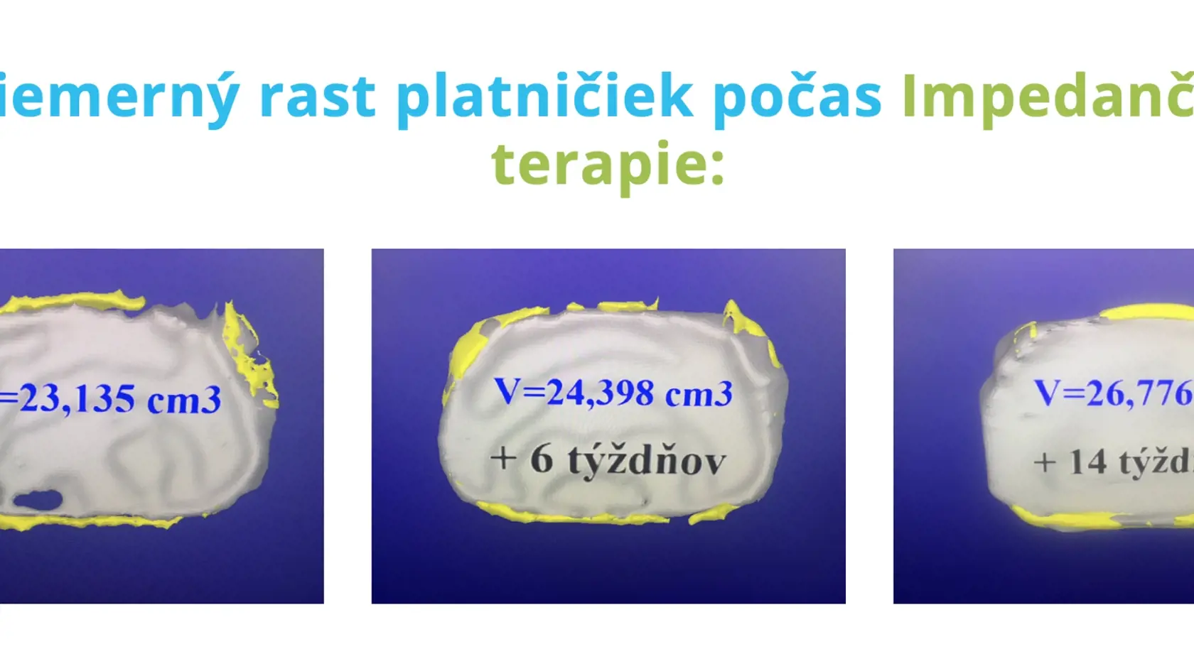 Život bez bolesti stojí za to. Problémy s chrbticou rieši aj impedančná terapia.