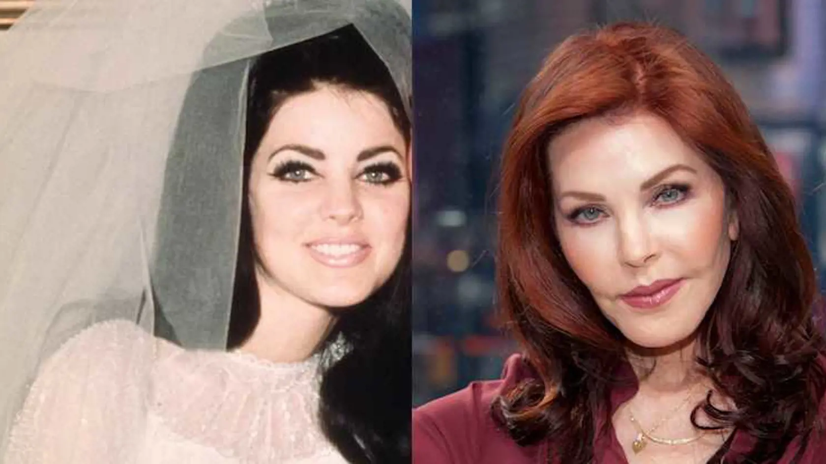 Priscilla Presley pred a po plastikách