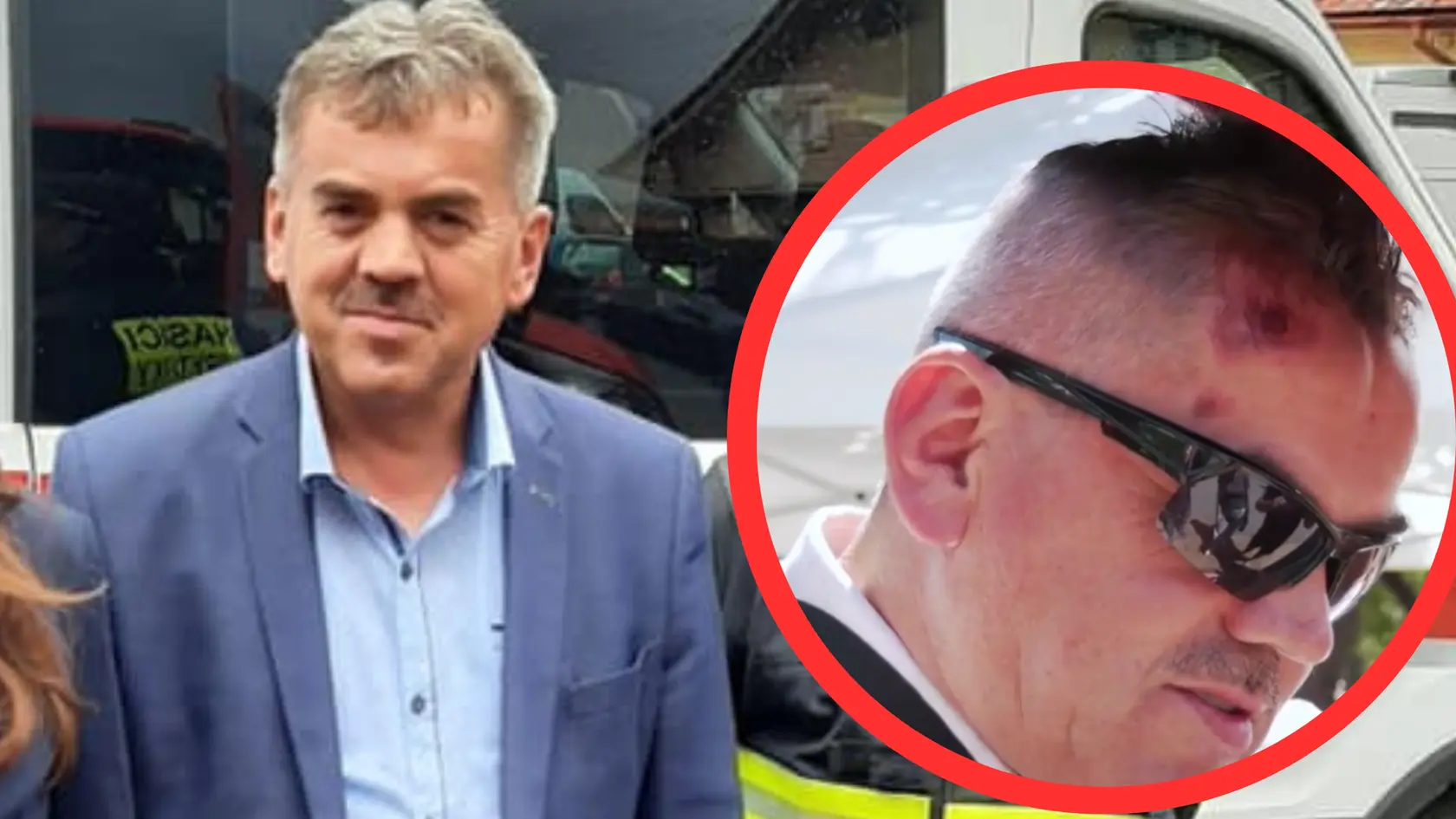Neznámy páchateľ napadol starostu priamo v garáži jeho rodinného domu.