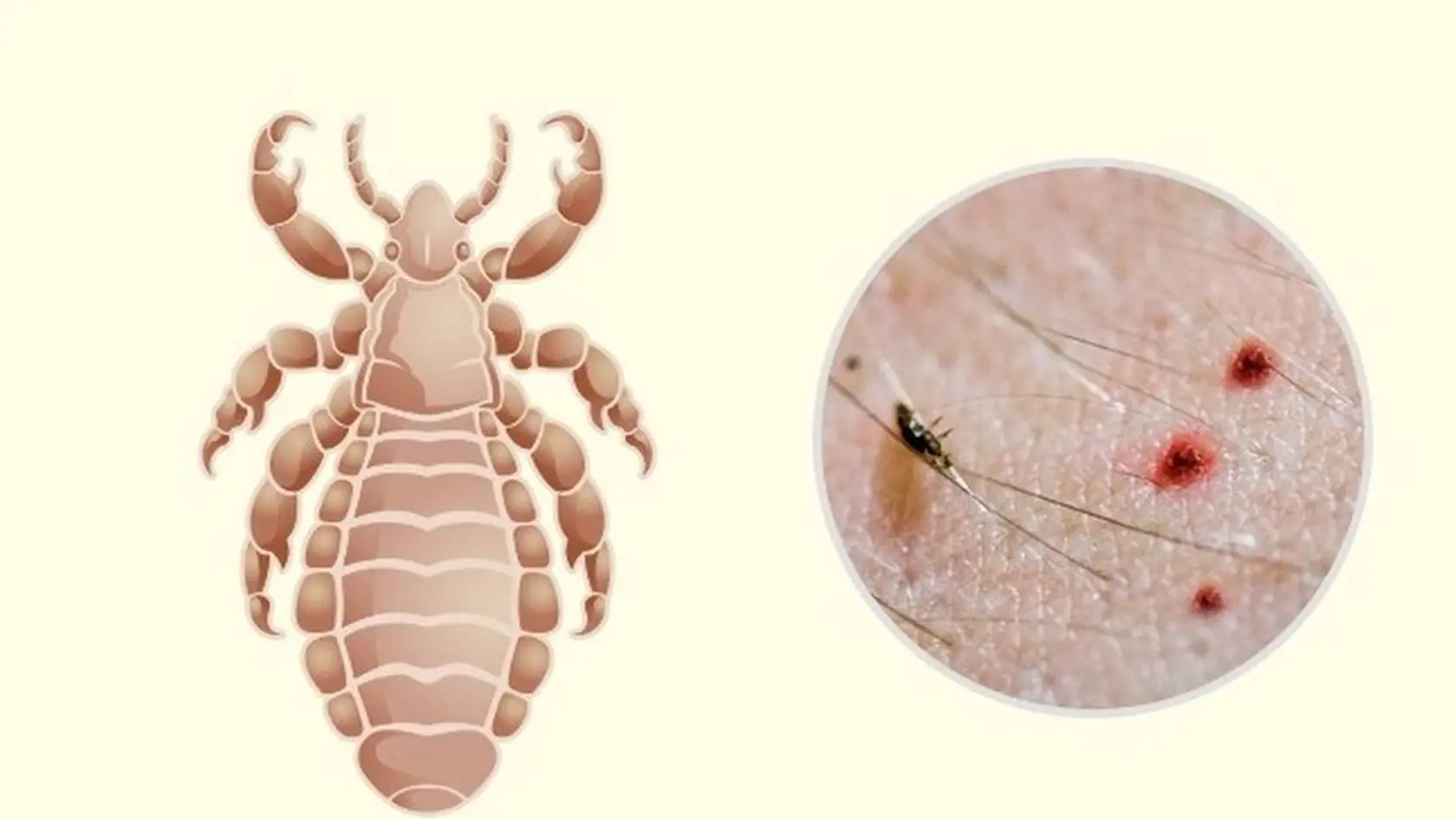 VOŠ