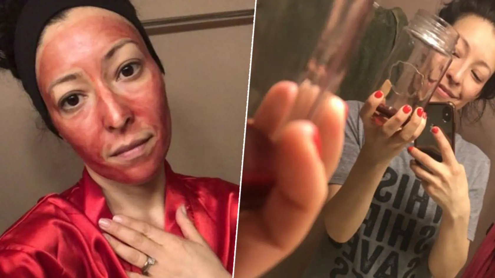 Ženy využívajú menštruačnú krv ako pleťovú masku. Odborníci to však neodporúčajú