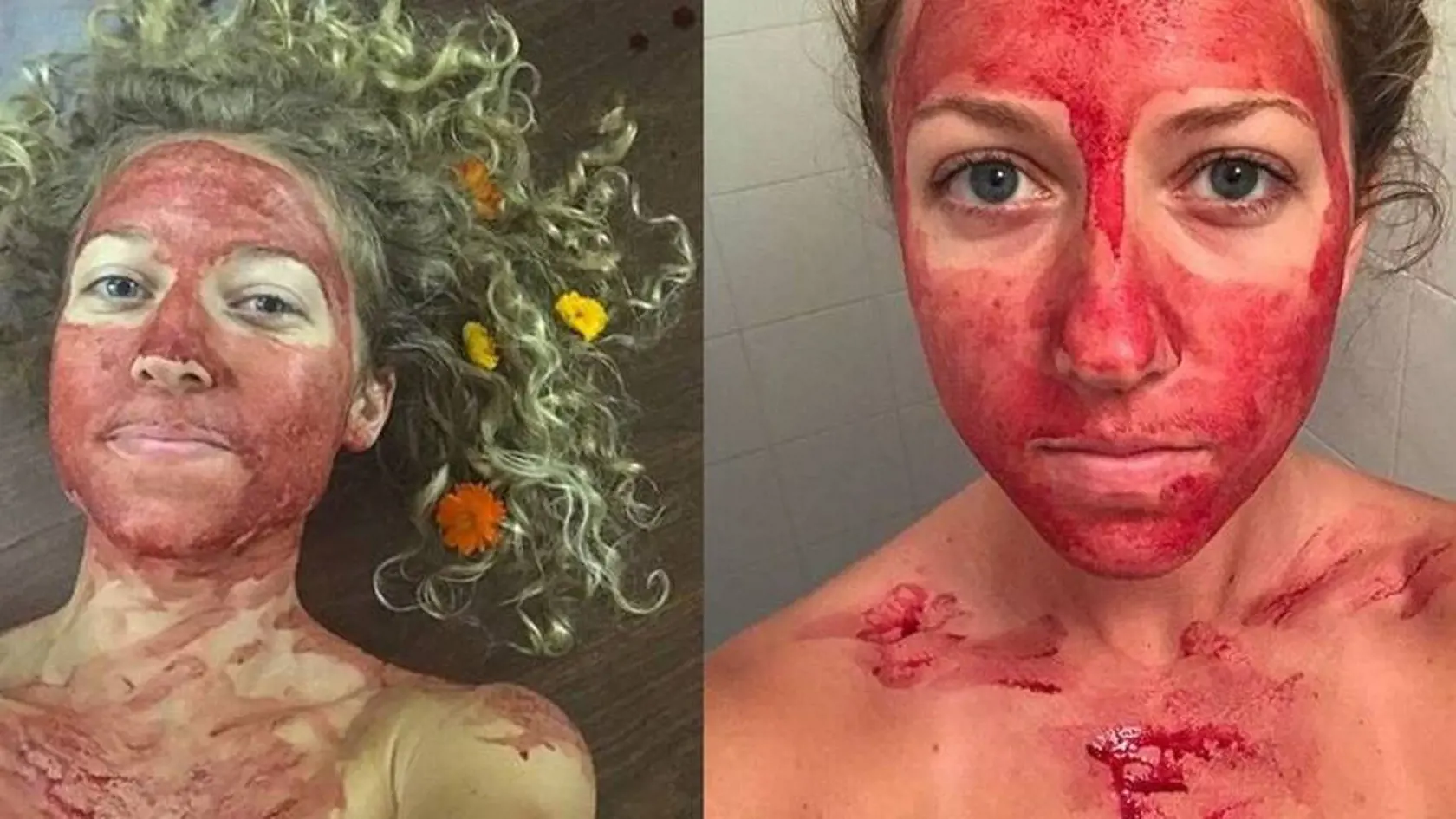 Ženy využívajú menštruačnú krv ako pleťovú masku. Odborníci to však neodporúčajú