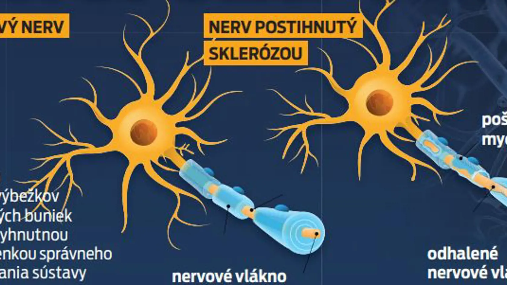 Mýtus: Keď nemám príznaky, nemusím užívať lieky.
Realita: Liečba je potrebná, a to aj v období remisie ochorenia. Opäť platí, že najlepšie výsledky liečby sú vtedy, ak sa liečba u pacientov začne čím skôr, vo včasných štádiách ochorenia. 

Mýtus: S liečbou stačí začať až vtedy, keď sa stav zhorší.
Realita: Liečba je veľmi dôležitá práve v skorých štádiách ochorenia. Včasná diagnostika a okamžitá liečba sú jediným spôsobom, ako spomaliť rozsiahle poškodenie centrálnej nervovej sústavy.