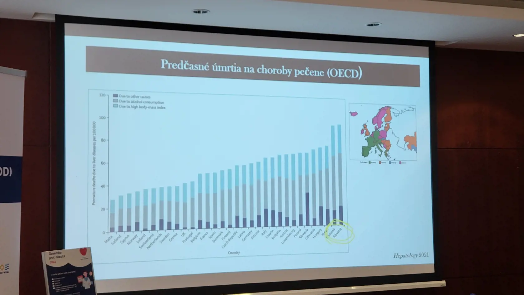 Na chorobu pečene, ktorú spôsobuje obezita zomierame najviac na svete.