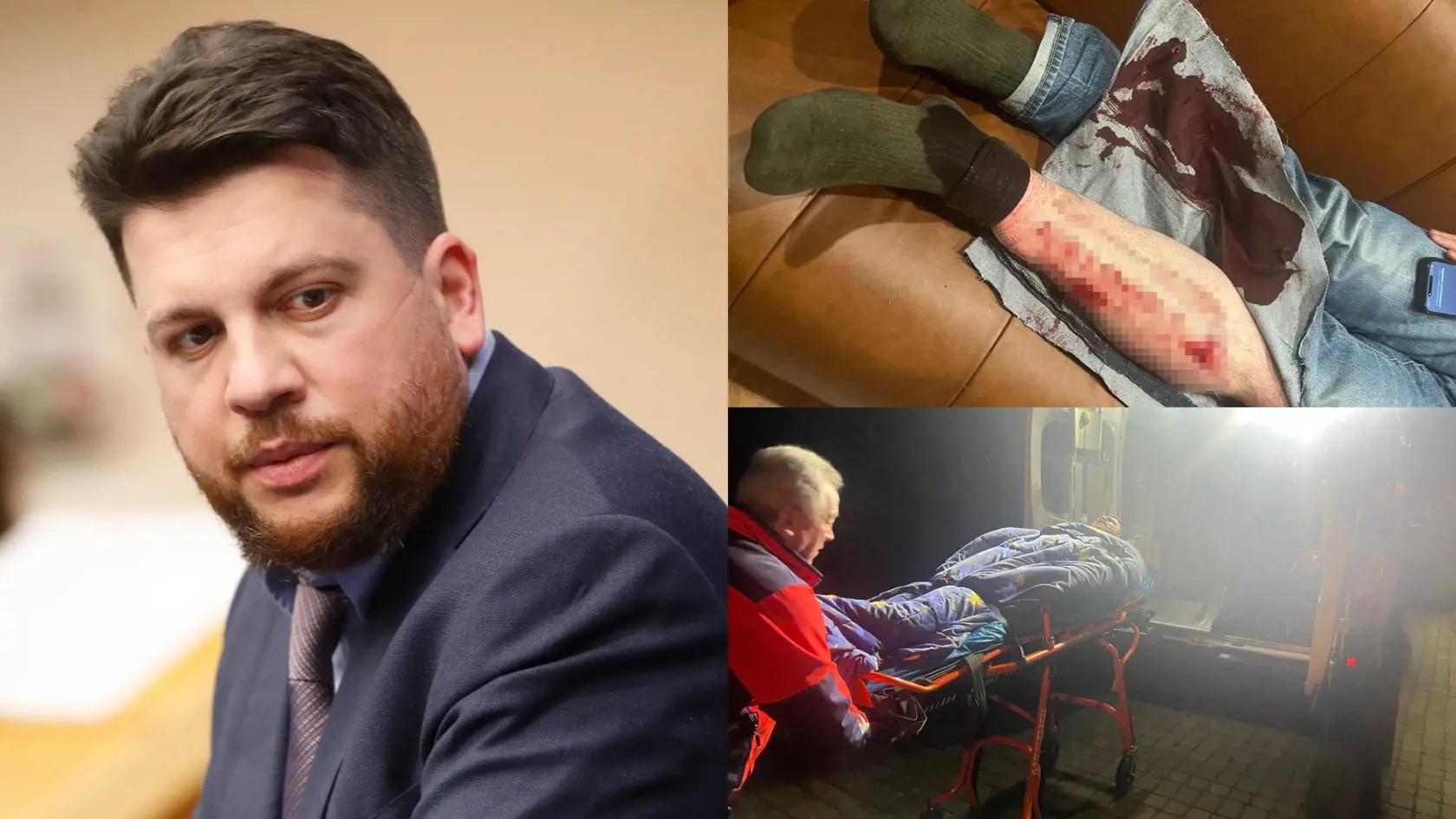 Ruský opozičný aktivista Leonid Volkov, ktorý bol blízkym spolupracovníkom vodcu ruskej opozície Alexeja Navaľného, bol v utorok večer terčom útoku.