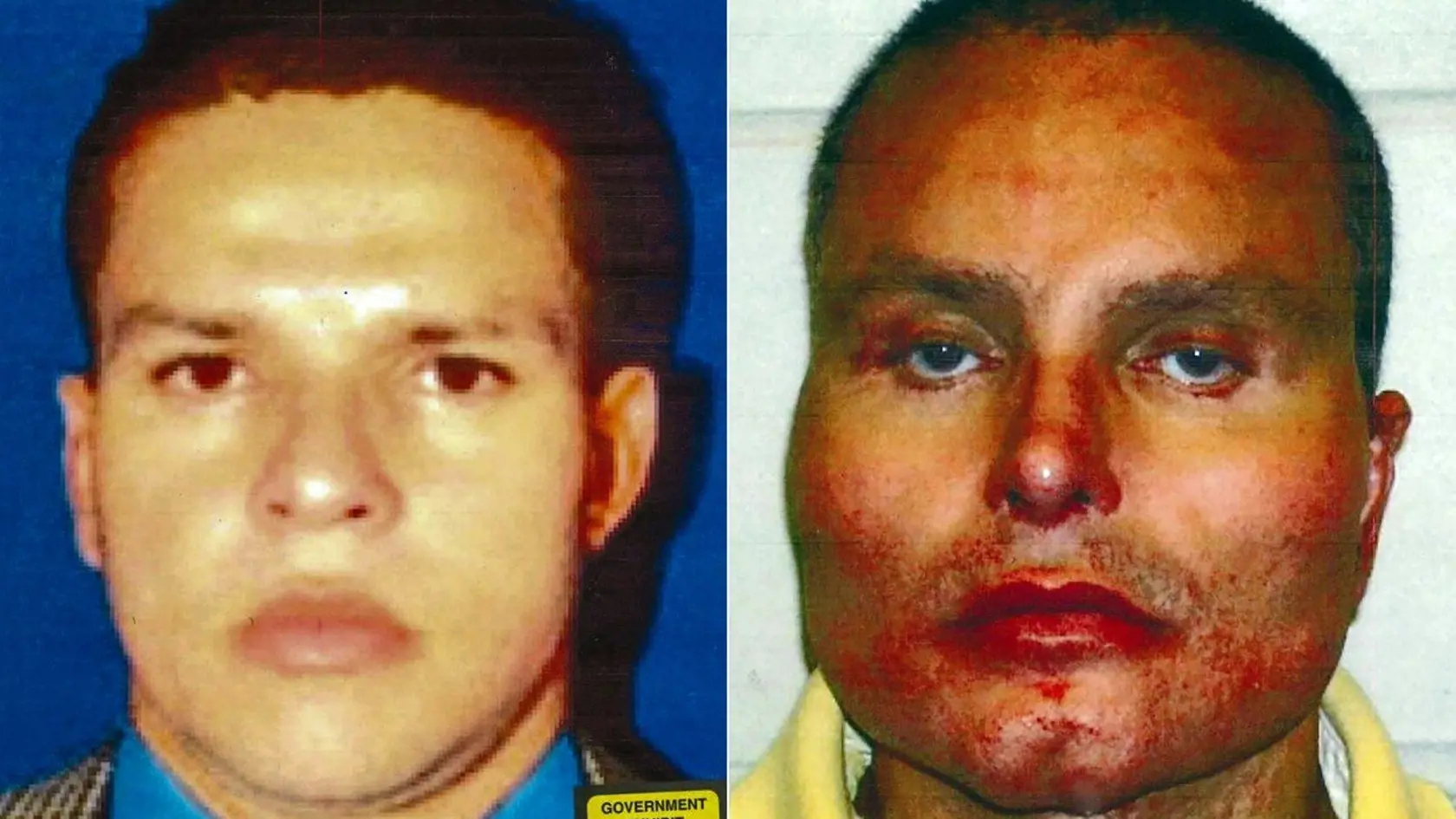 Juan Carlos Ramirez Abadia po plastickej operácii.