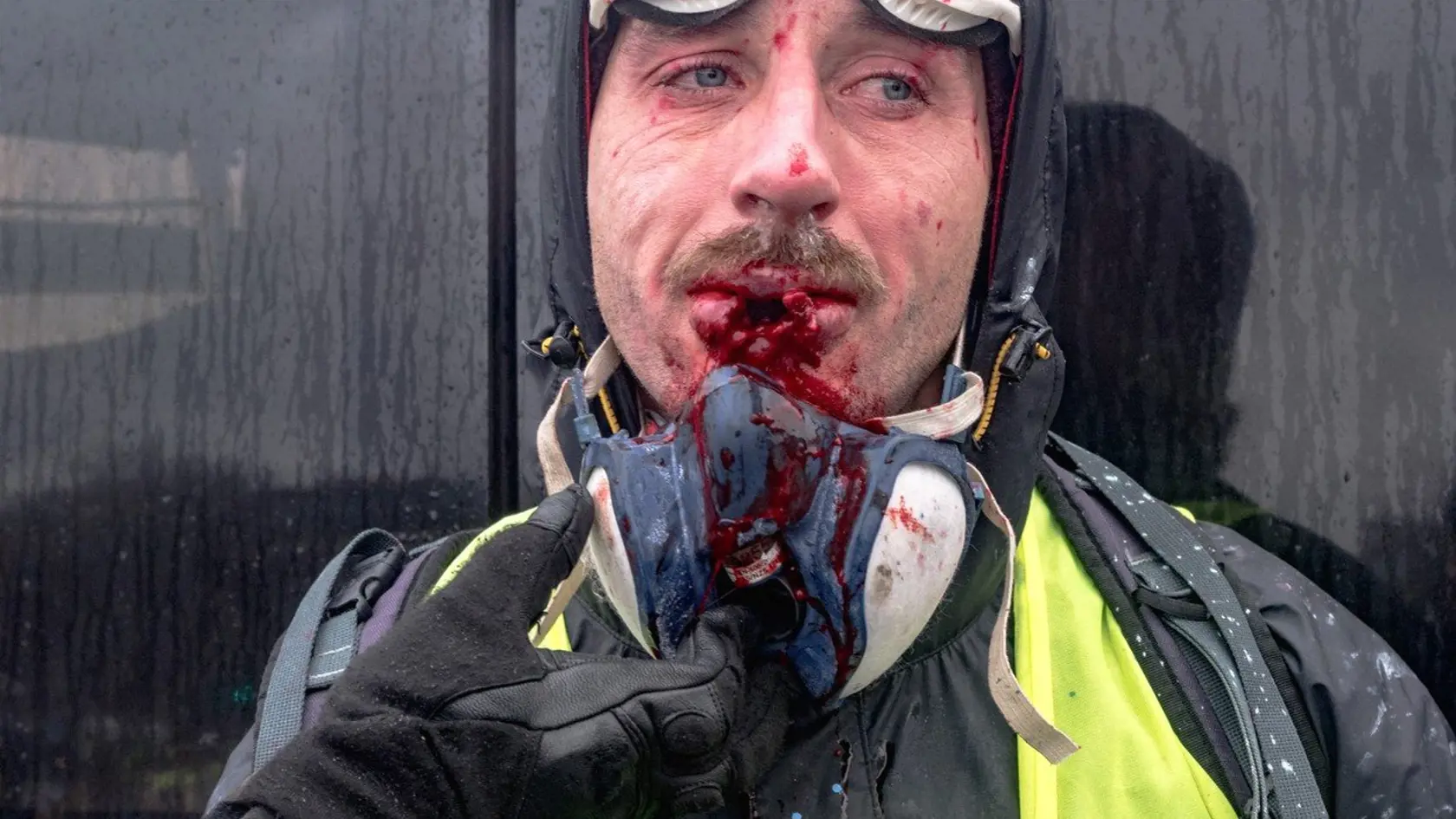 K nebesiam stúpal dym, ulice horeli a ľuďom tiekla po tvárach krv: víkendovú idylku Paríža spálili tzv. „žlté vesty“. Ich protesty sú vôbec najhoršími v krajine za posledných vyše 10 rokov.