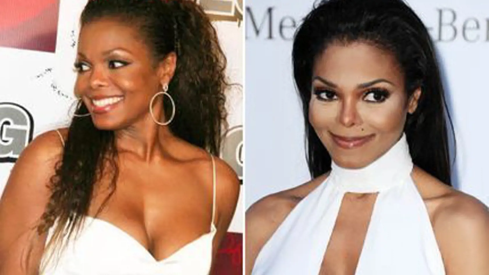 Janet Jackson sa po plastických operáciách podobá viac a viac na jej zosnulého brata.
