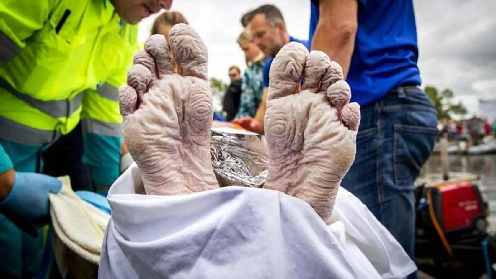 Chodidlá olympijského šampióna Maartena Van Der Weijdena po tom, čo zaplával 163 km za 55 hodín.