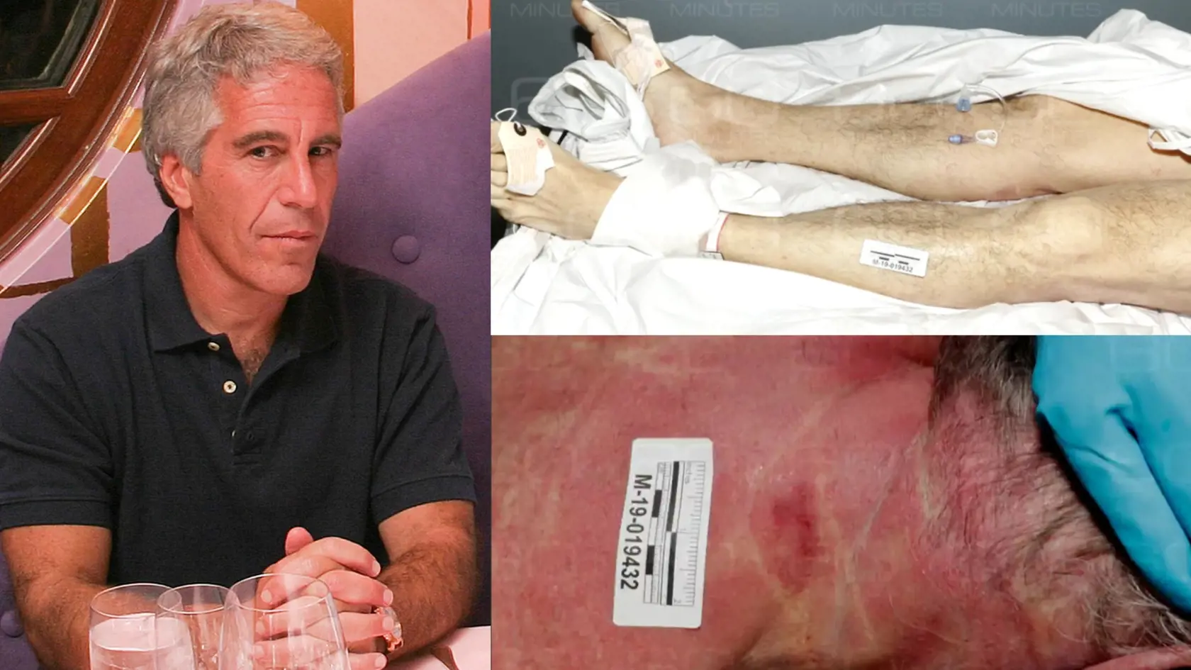 Epstein (†66)