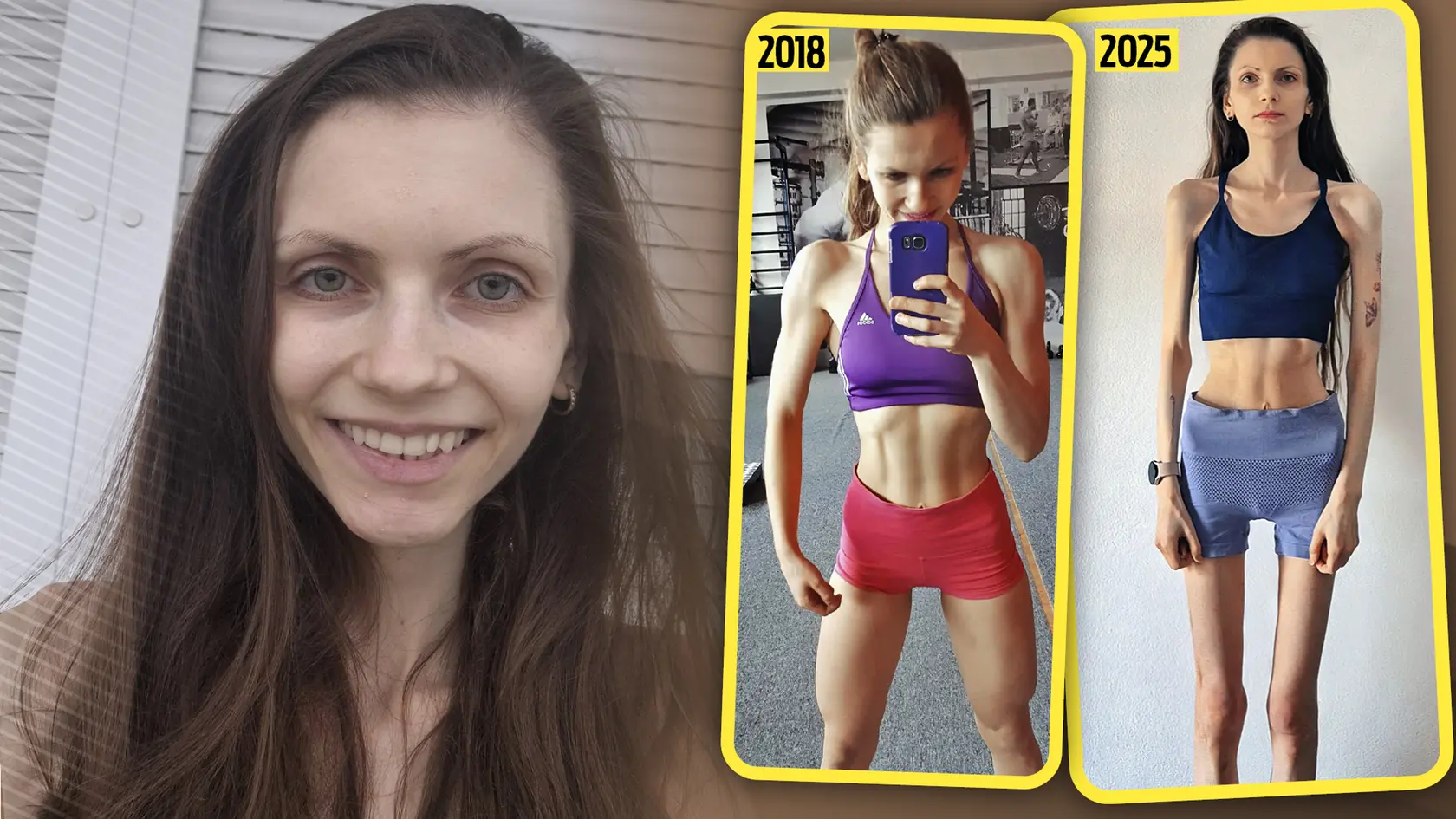 Za pár rokov schudla na 31 kg. 