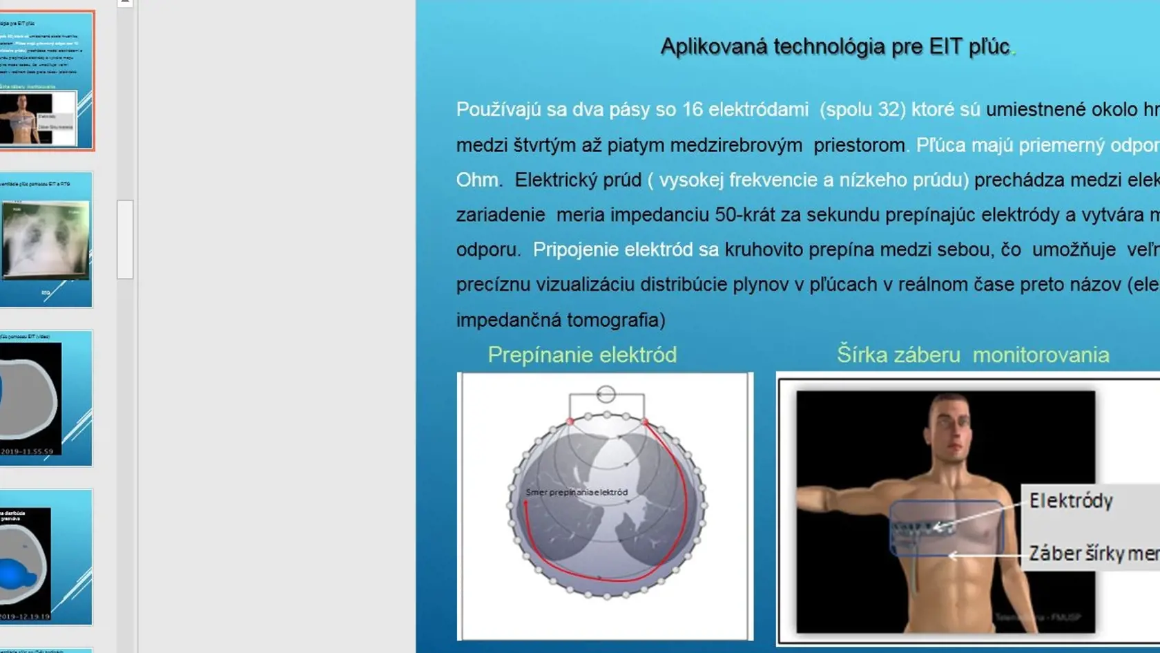 Na Slovensku sa podarilo skonštruovať prvý ventilátor na svete, ktorý umožňuje ventilovať s pľúca metódou Programovaná viac hladinová ventilácia pľúc s premenlivými tlakmi, objemami, časom a prietokmi.