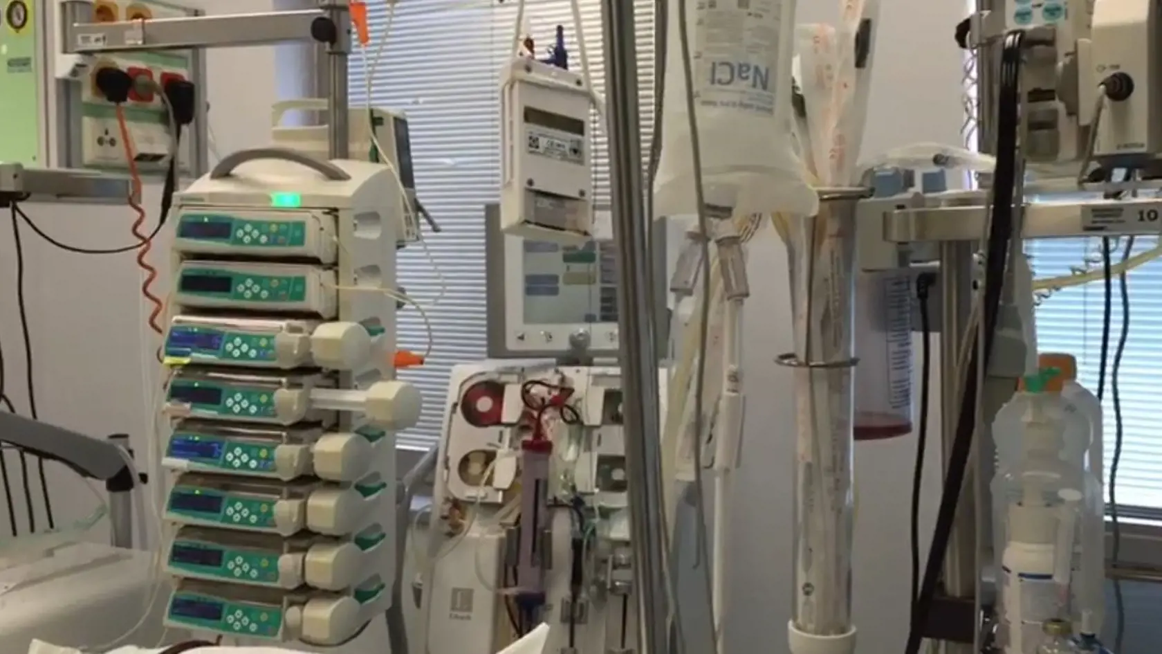 Na Slovensku sa podarilo skonštruovať prvý ventilátor na svete, ktorý umožňuje ventilovať s pľúca metódou Programovaná viac hladinová ventilácia pľúc s premenlivými tlakmi, objemami, časom a prietokmi.