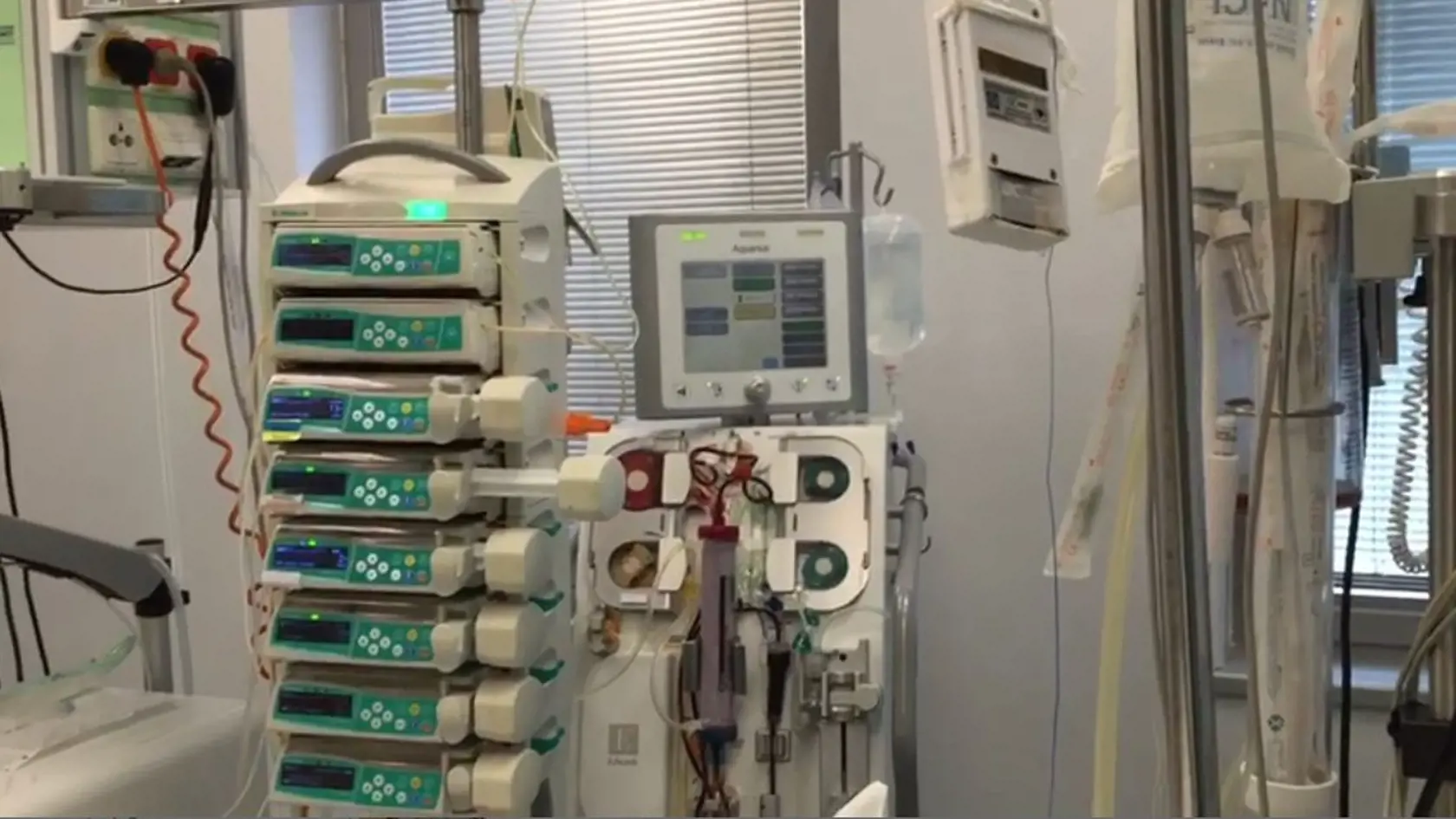 Na Slovensku sa podarilo skonštruovať prvý ventilátor na svete, ktorý umožňuje ventilovať s pľúca metódou Programovaná viac hladinová ventilácia pľúc s premenlivými tlakmi, objemami, časom a prietokmi.