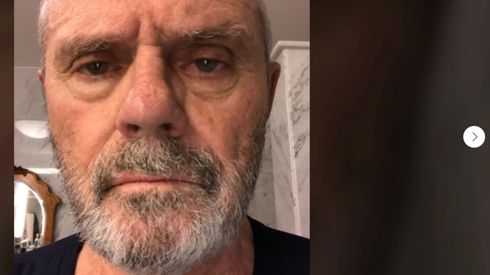 Herec Milan Kňažko (75) koncom septembra oznámil, že je covid pozitívny. Teraz zverejnil svoju aktuálnu selfie bez akýchkoľvek filtrov a poďakoval zdravotníkom