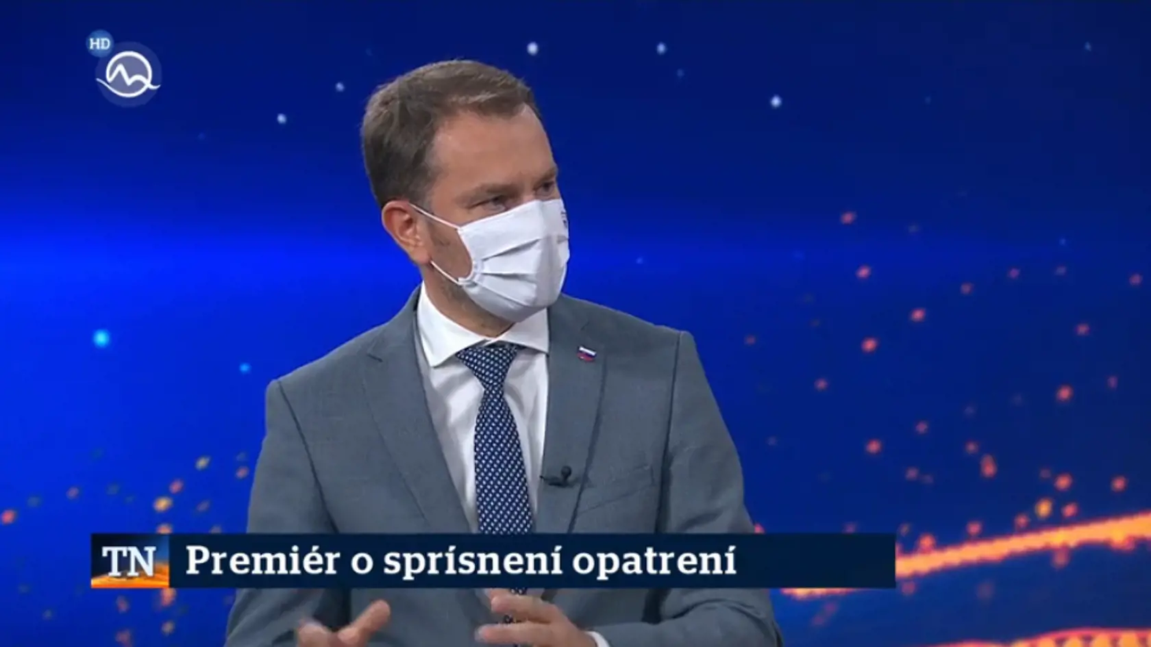 Igor Matovič si servítku pred ústa rozhodne nedáva. V zákulisí Markízy počastoval exministra Žigu nechutnými nadávkami.