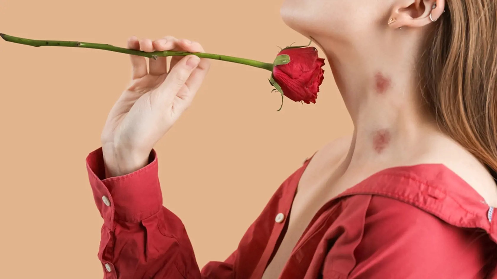 Young,Woman,With,Love,Bites,On,Her,Neck,Holding,Rose