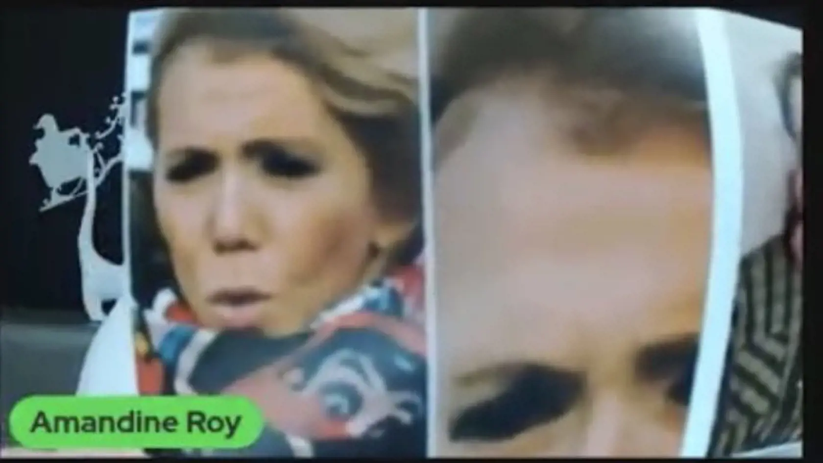 Novinárka Natacha Rey poukázala na plešinu pod jej vlasmi.