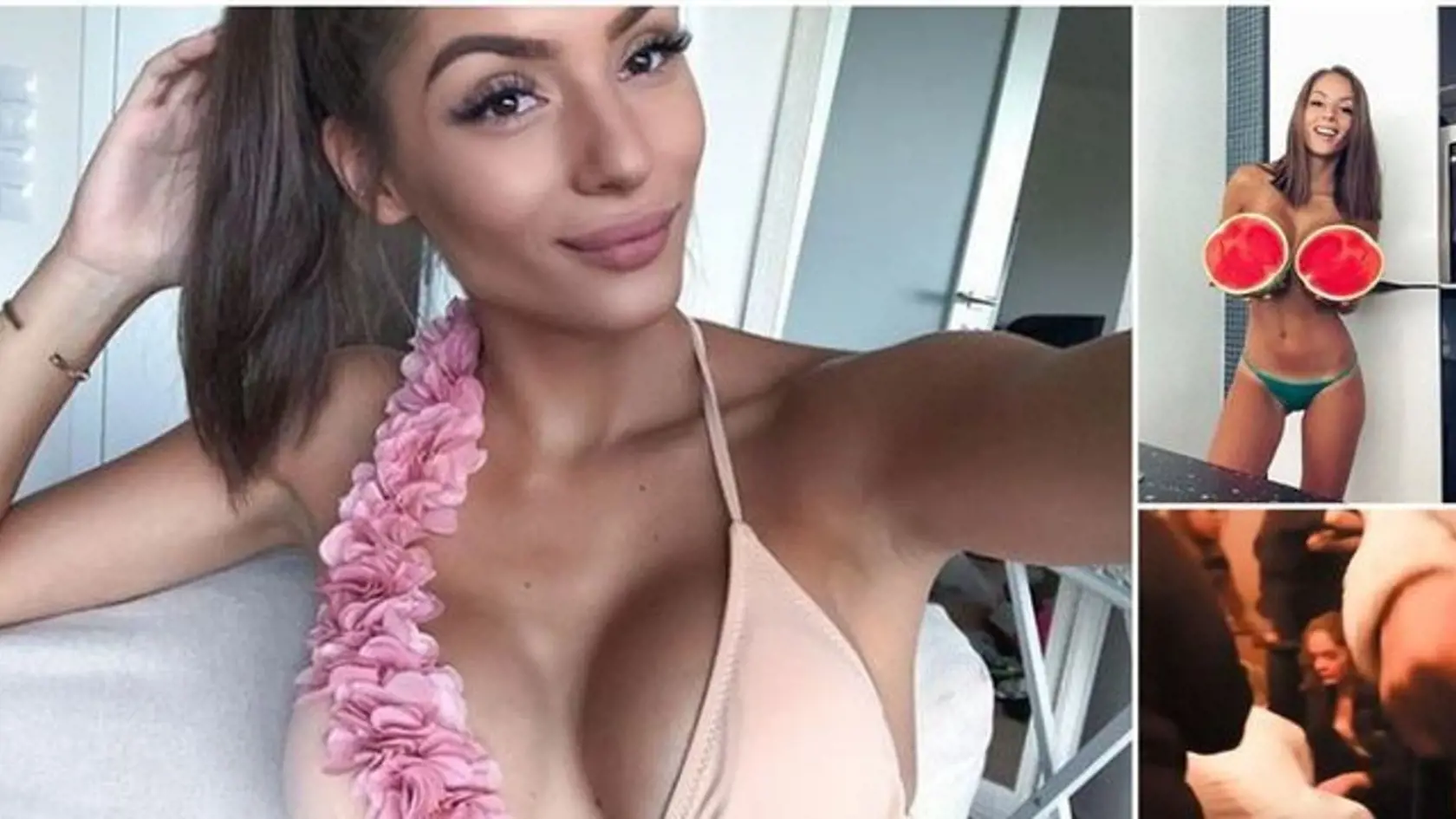Mladá a krásna česká Youtuberka, ktorú jej fanúšikovia poznajú ako Týnuš Třešničková bola navštíviť po prvý krát Istambul. Tento výlet však nedopadol podľa predstáv a 22-ročná blogerka skončila s popáleninami na 35 % tela. Po dlhom čase sa odhodlala prehovoriť o svojom zážitku a ukázala fotku, ktorú odfotila aj so svojim priateľom tesne pred hrôzostrašnou nehodou.
