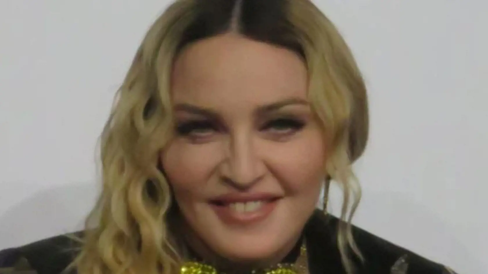 Madonna mala v minulosti omnoho guľatejšiu tvár.