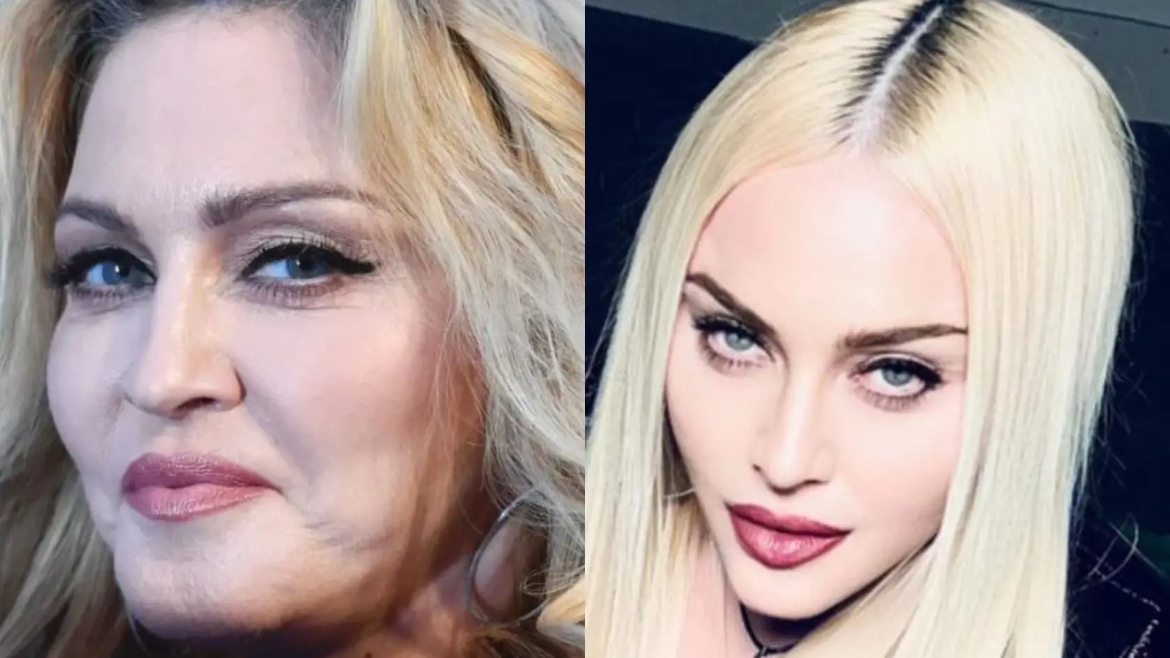 Na novej fotografii, ktorú speváčka zverejnila tento týždeň je tiež viditeľný rozdiel v tvare a veľkosti jej pier. Napriek tomu, že ich mala Madonna už predtým dostatočne plné, dnes sú jej pery ešte o niečo väčšie a rovnako sa mierne zmenil aj ich tvar.