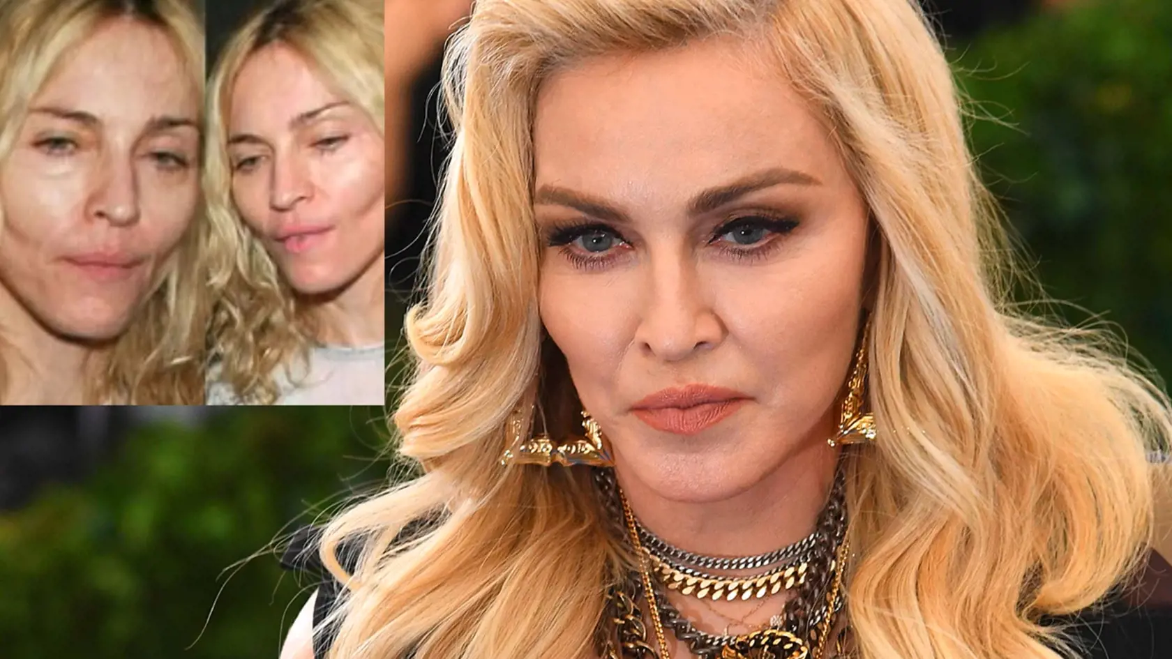 Podstúpila Madonna plastickú operáciu?