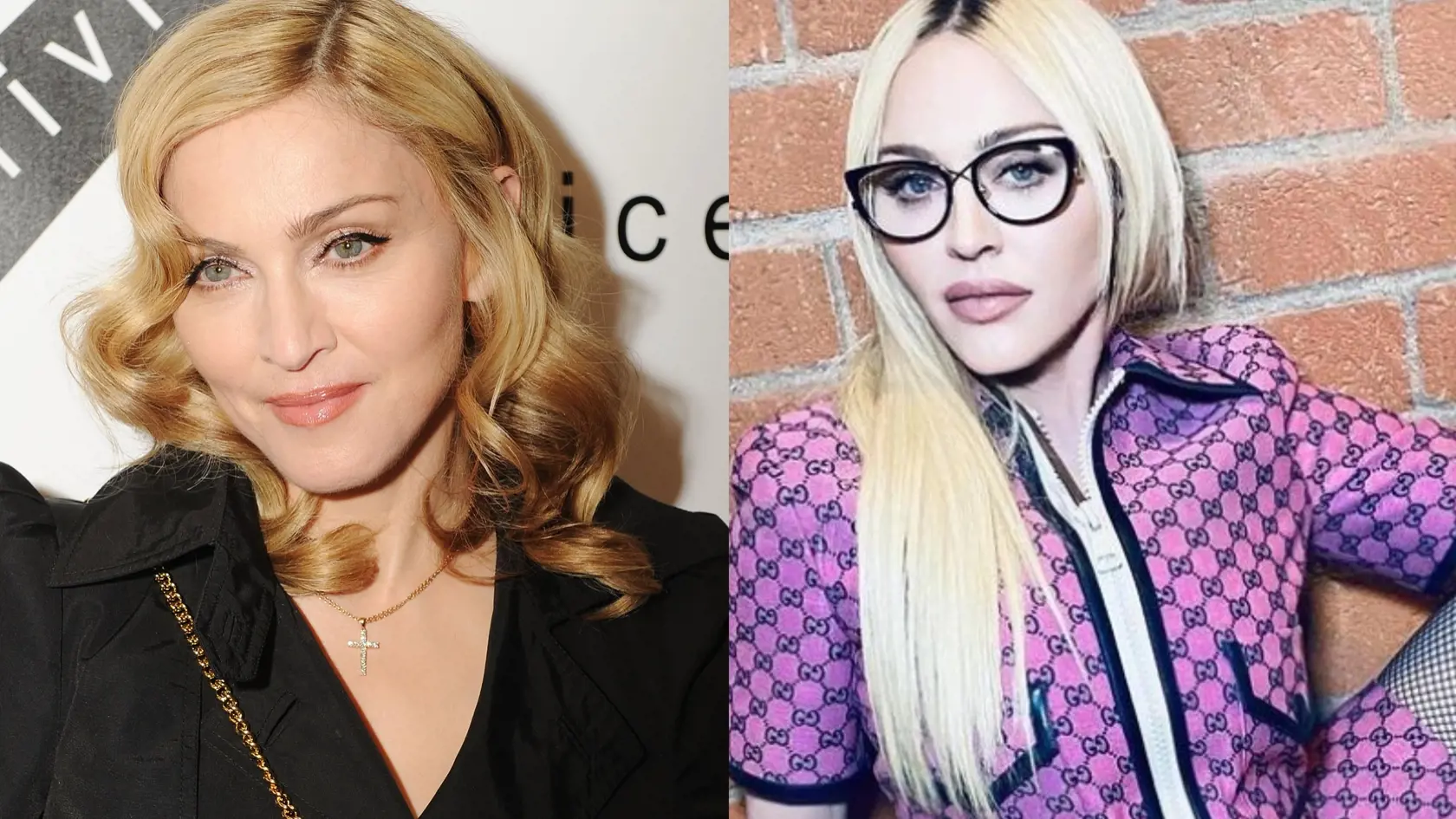 Madonna v roku 2010 a dnes.