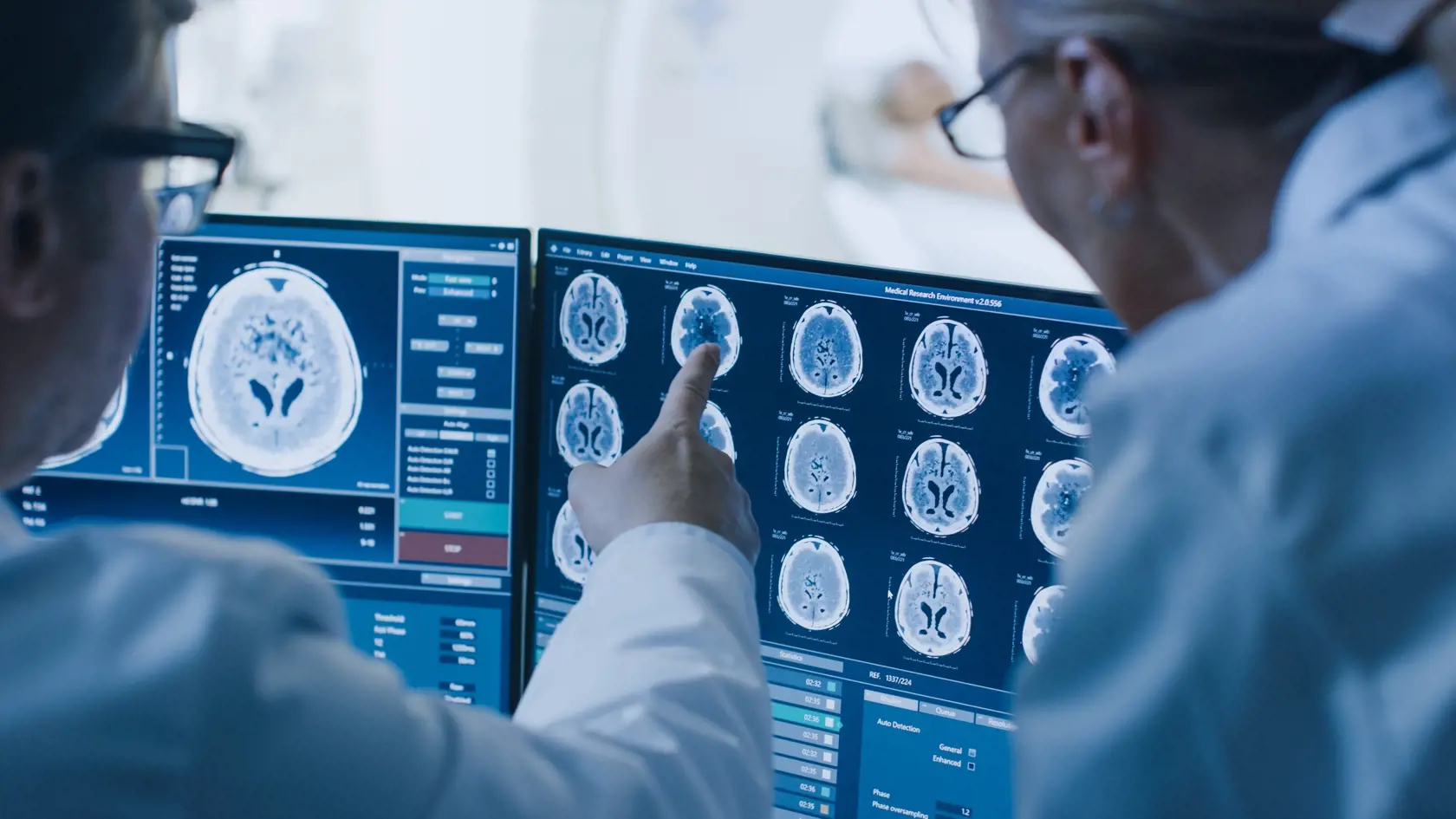 Lekári,doktori,vedci,mozog,umelá inteligencia,počítač,CT,CT scan,CT sken,MRI,sken,zdravotníctvo,rakovina,rakovina mozgu