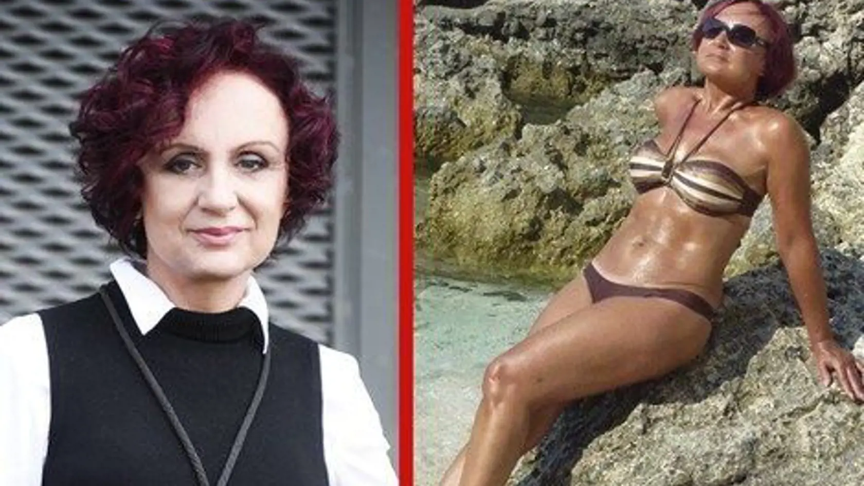 Petra Janů plastické operácie netají.